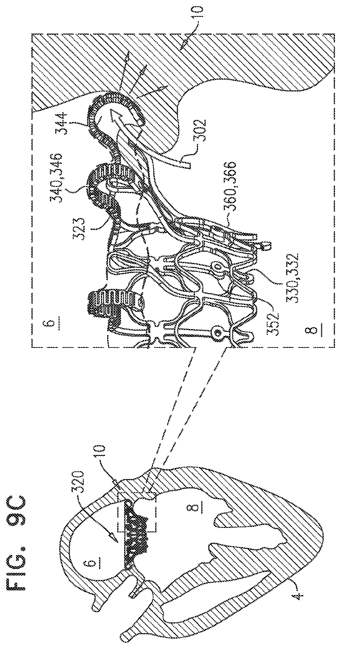 Patent US11793635 Figure 15 – Prosthetic valve with angularly offset frames