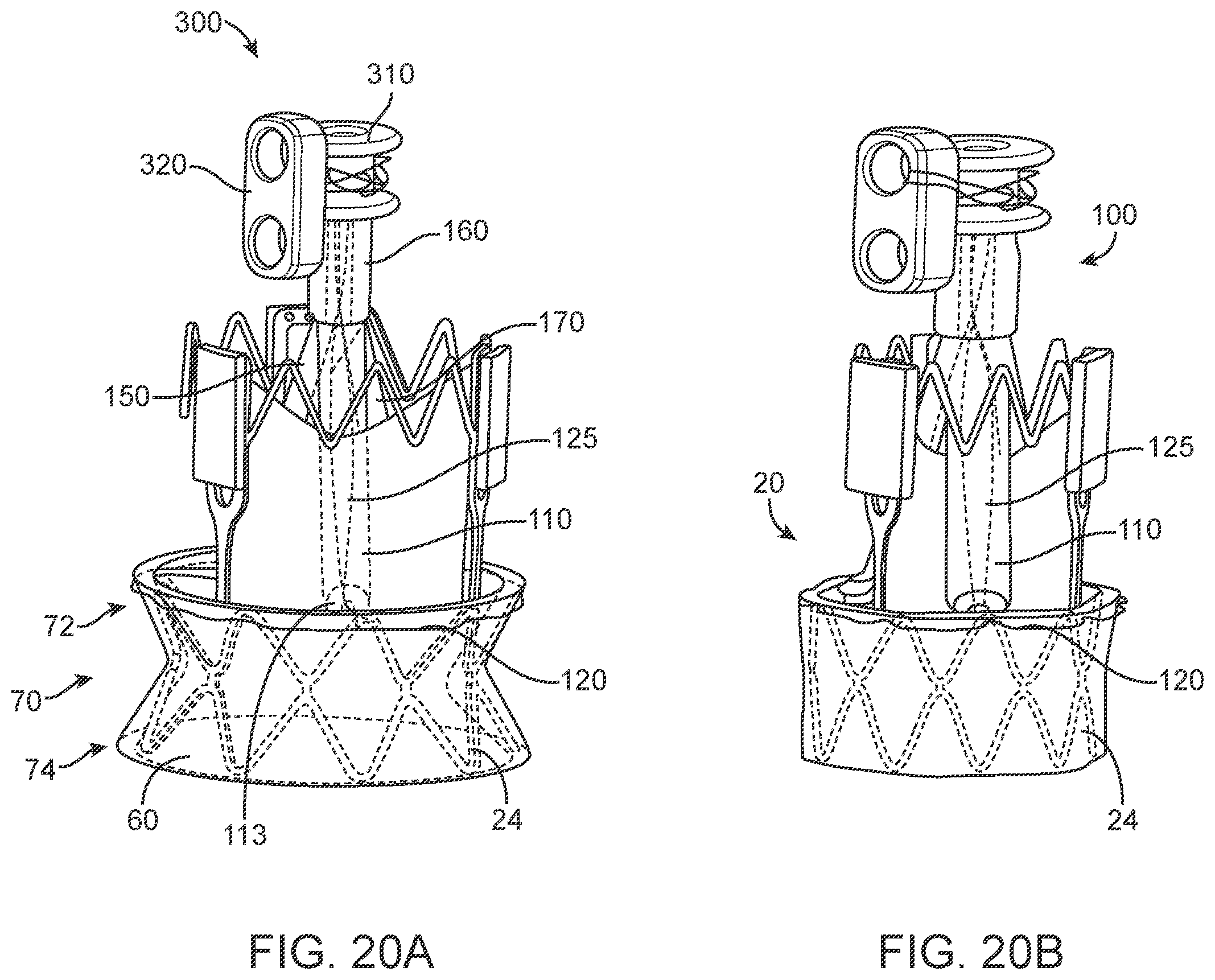 Patent US11793637 Figure 16 – Valve delivery tool