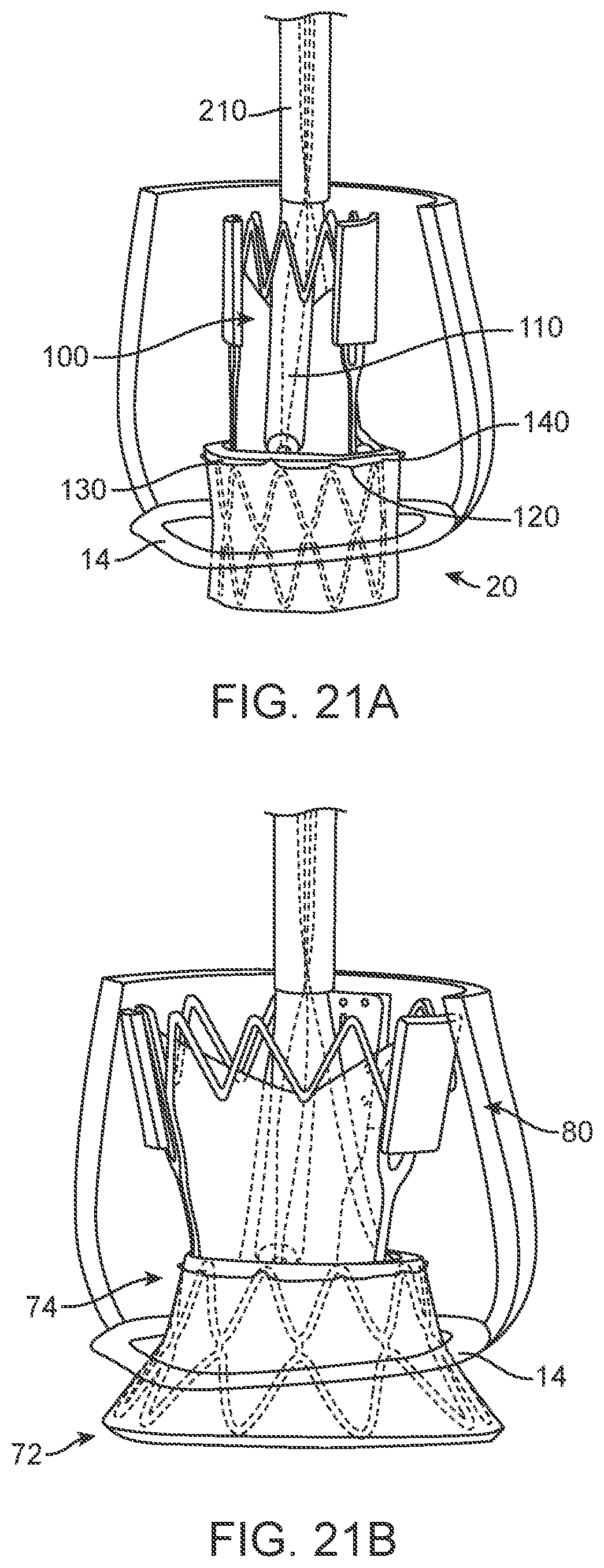 Patent US11793637 Figure 17 – Valve delivery tool