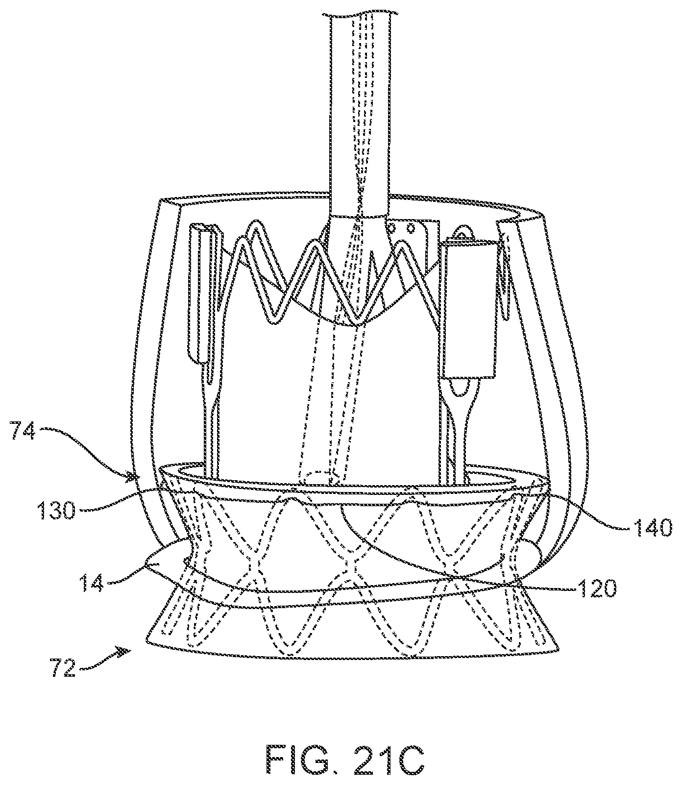 Patent US11793637 Figure 18 – Valve delivery tool
