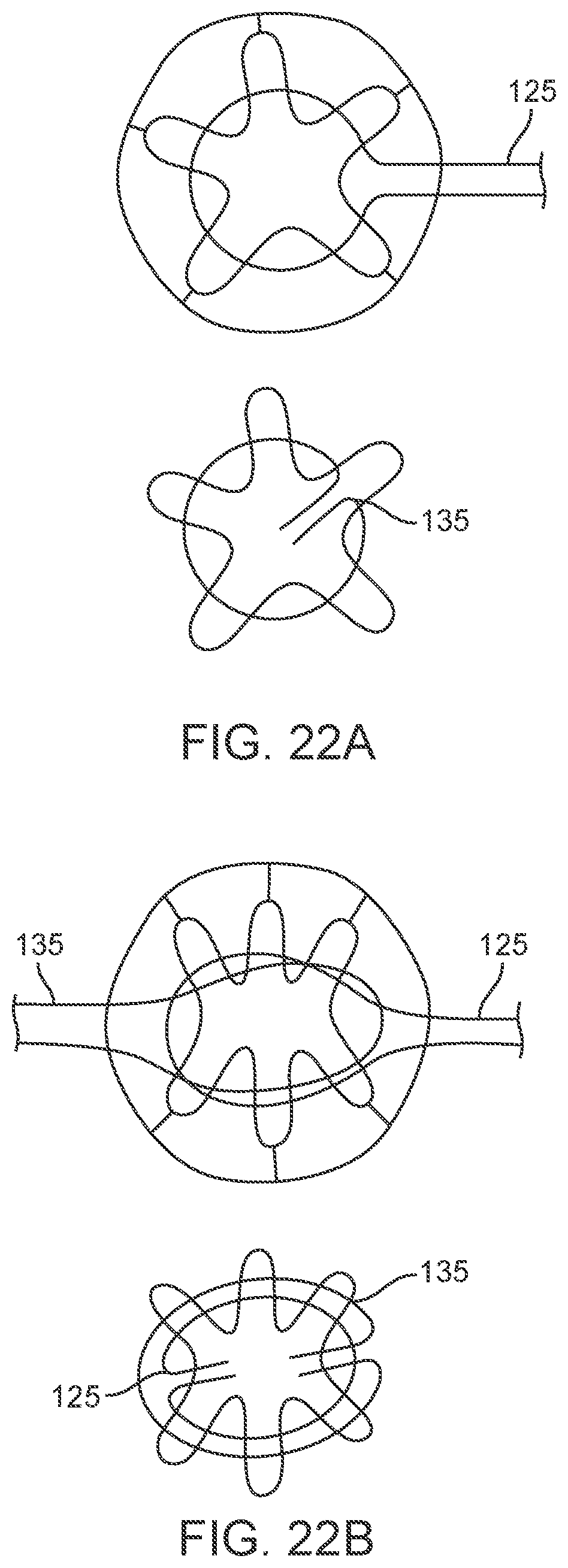 Patent US11793637 Figure 20 – Valve delivery tool