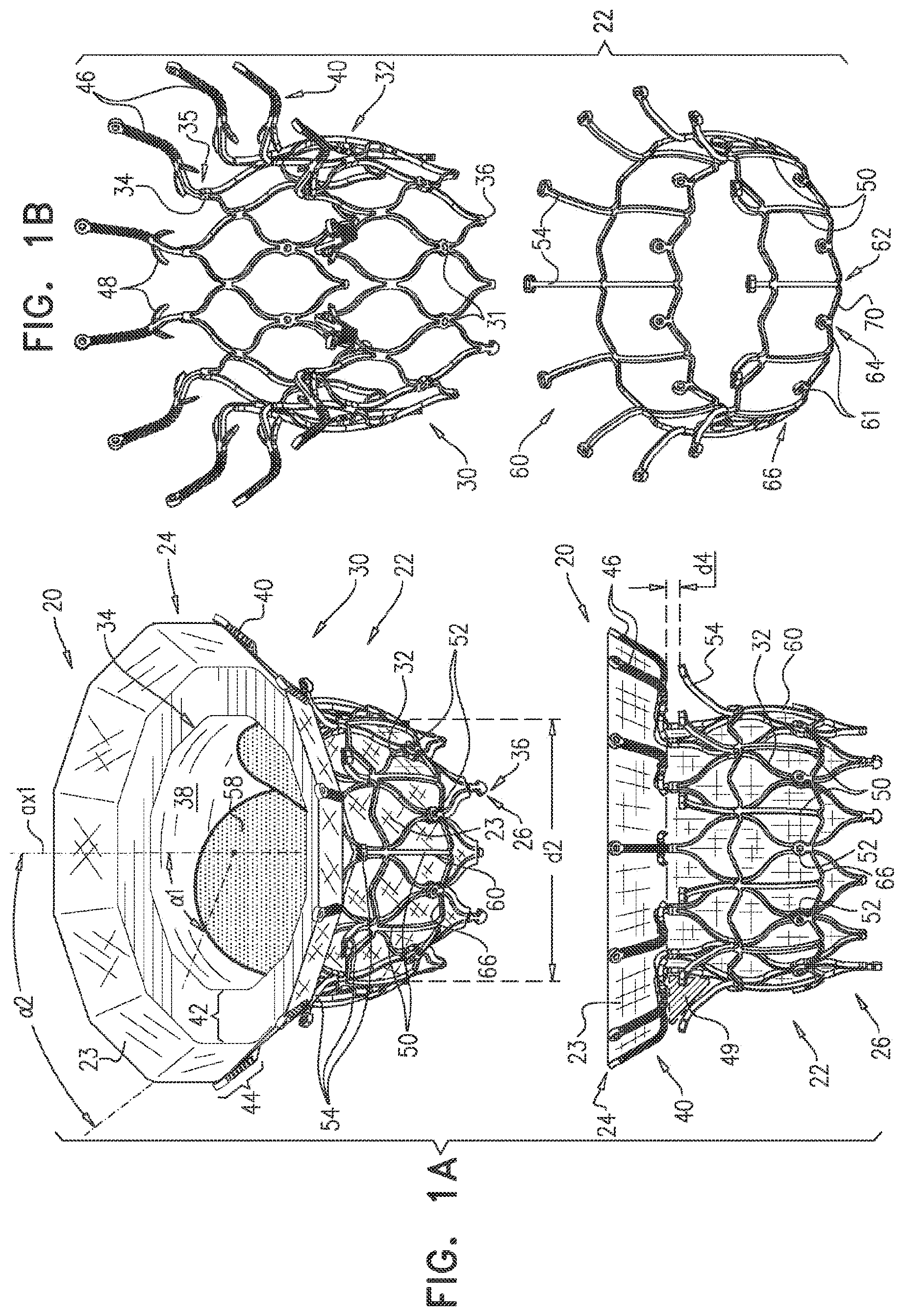 Patent US11793638 — Prosthetic valve with pivoting tissue anchor portions — Figure 1