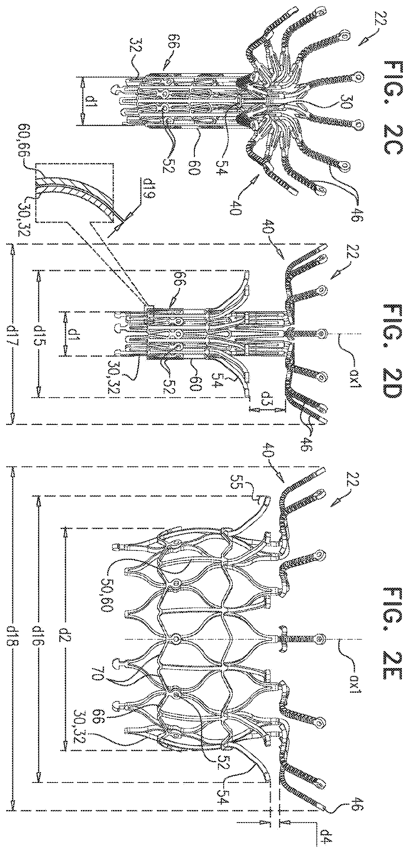 Patent US11793638 Figure 3 – Prosthetic valve with pivoting tissue anchor portions