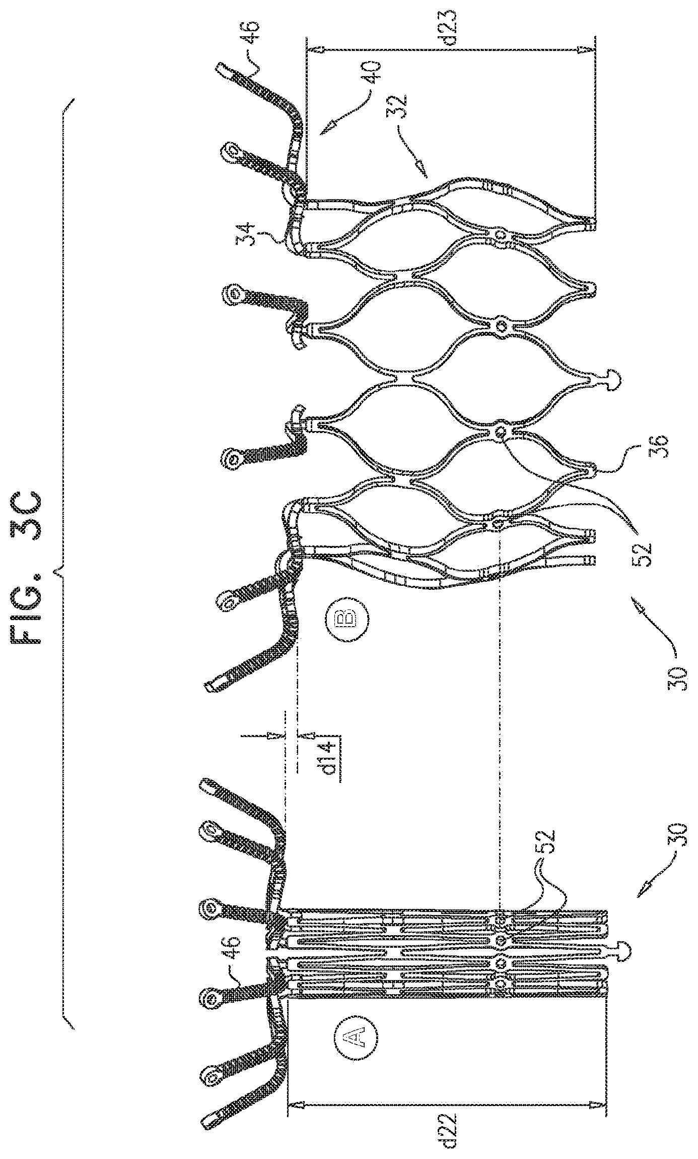 Patent US11793638 Figure 6 – Prosthetic valve with pivoting tissue anchor portions
