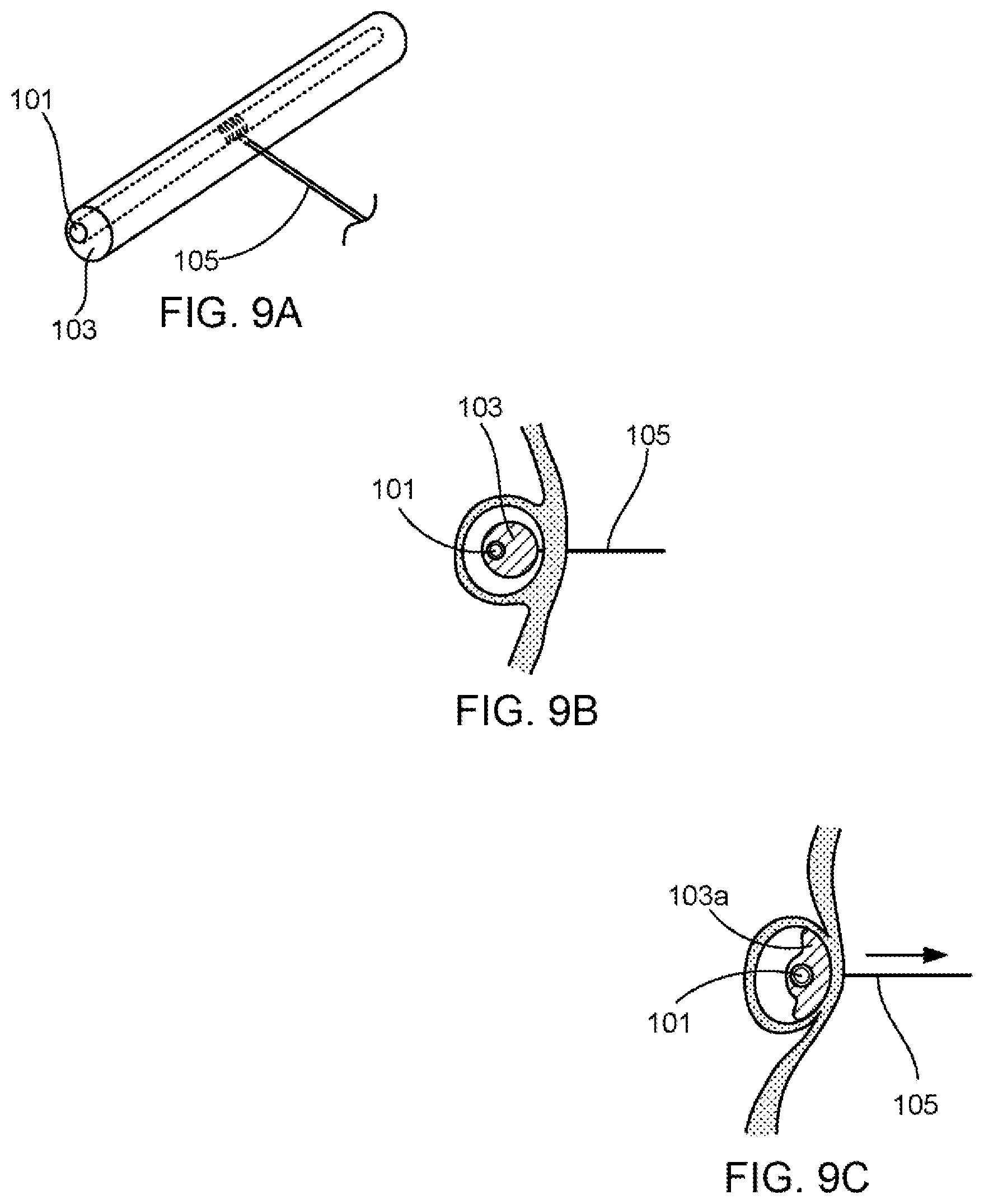 Patent US11793639 Figure 5 – Devices, systems and methods for reshaping a heart valve annulus