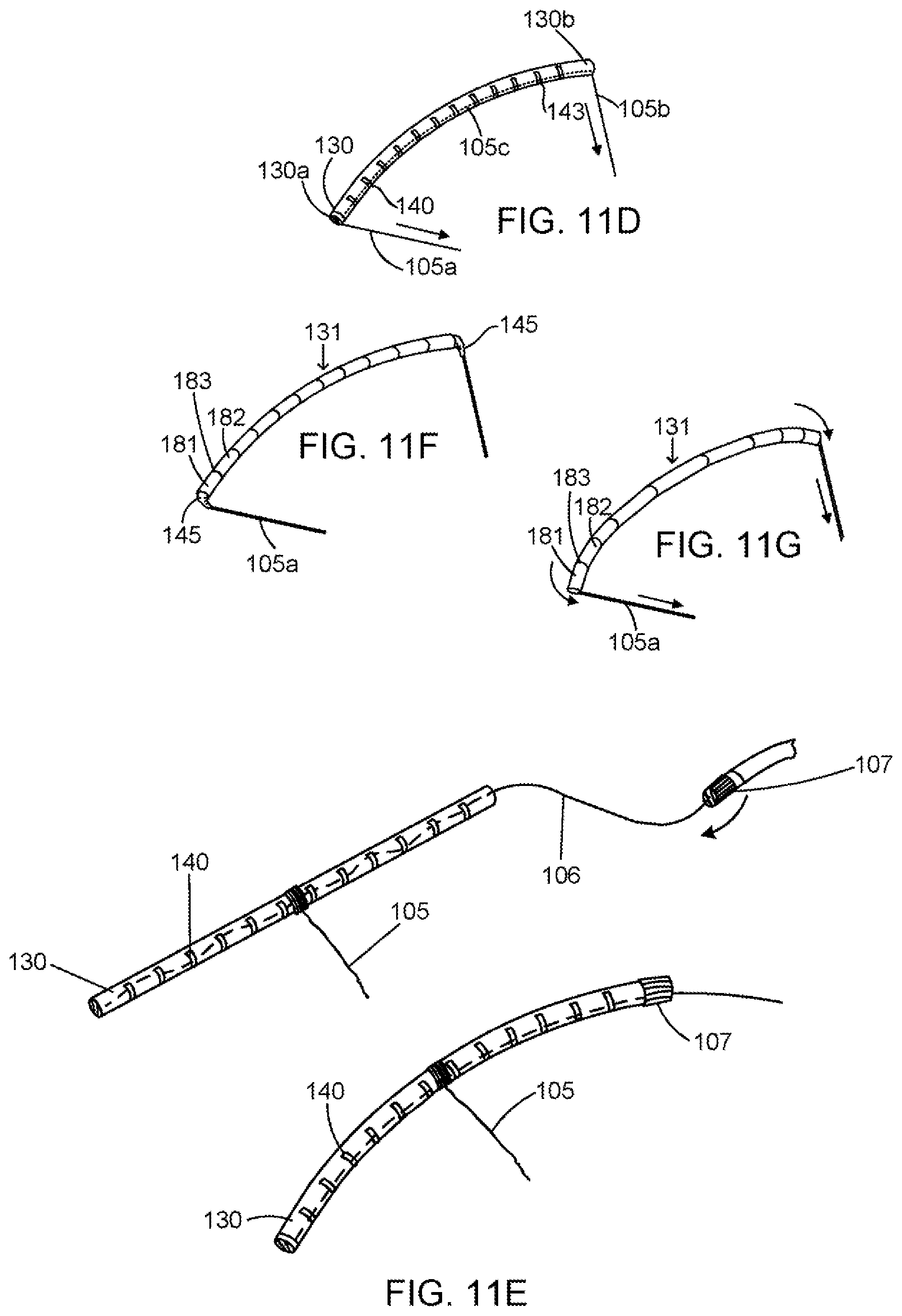 Patent US11793639 Figure 9 – Devices, systems and methods for reshaping a heart valve annulus