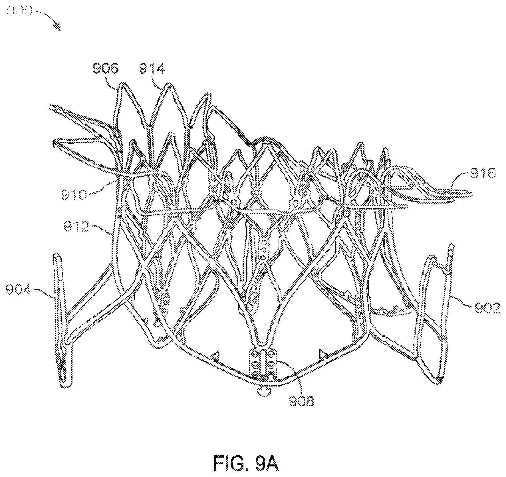 Patent US11793640 Figure 11 – Sequentially deployed transcatheter mitral valve prosthesis