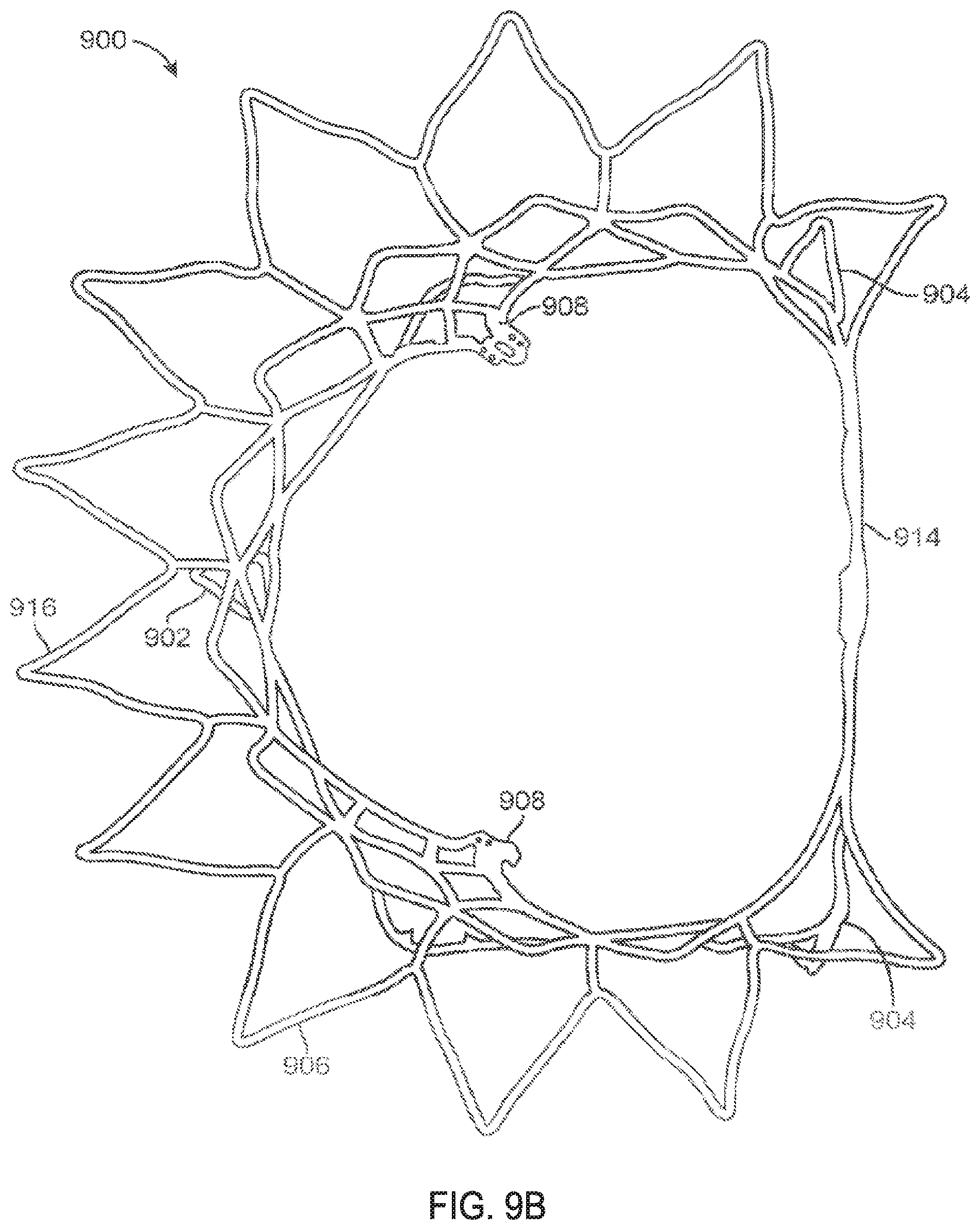 Patent US11793640 Figure 12 – Sequentially deployed transcatheter mitral valve prosthesis