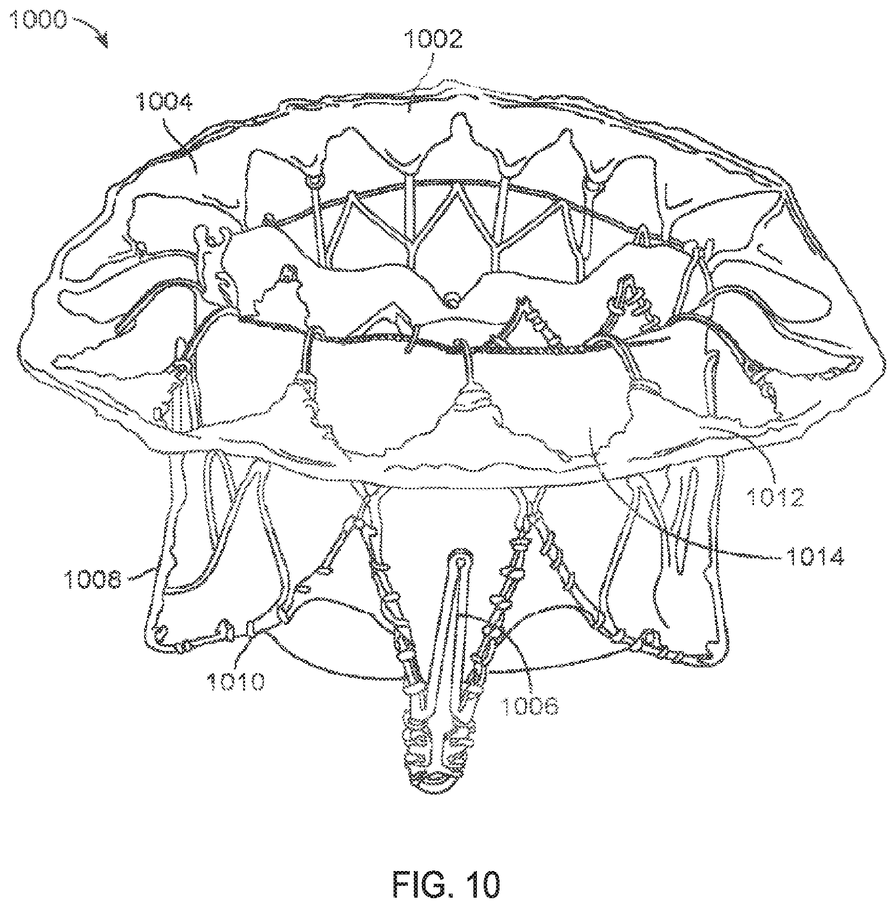 Patent US11793640 Figure 13 – Sequentially deployed transcatheter mitral valve prosthesis