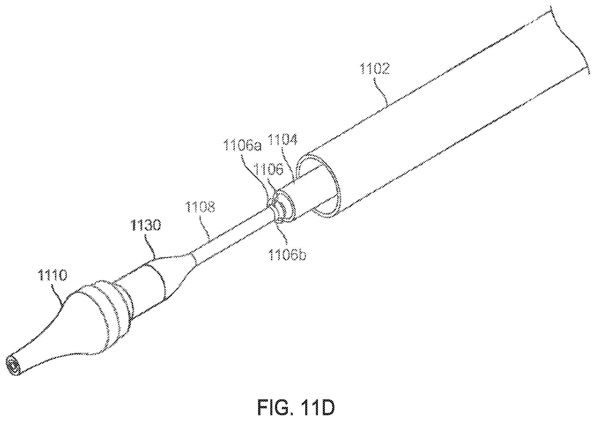 Patent US11793640 Figure 17 – Sequentially deployed transcatheter mitral valve prosthesis