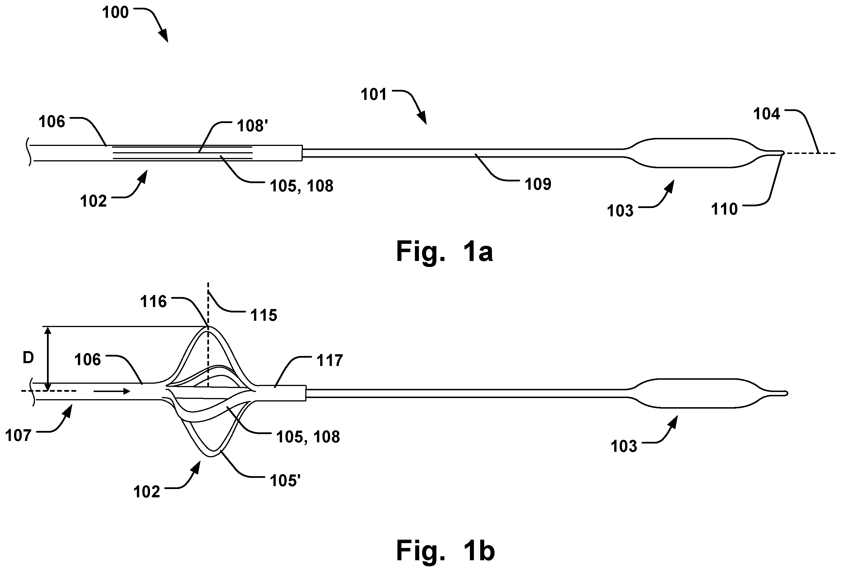 Patent US11793641 Figure 1 – Medical system for annuloplasty