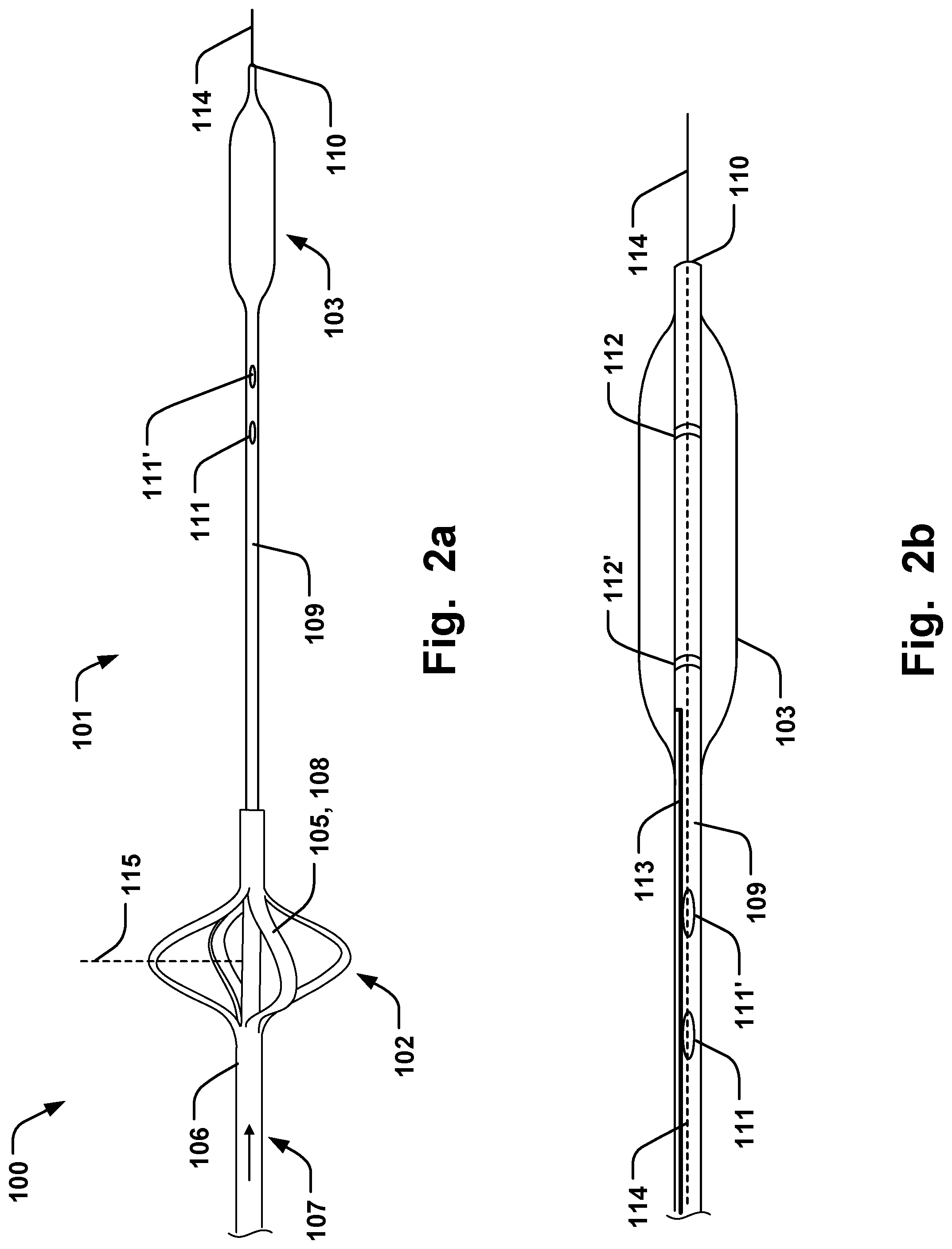 Patent US11793641 Figure 2 – Medical system for annuloplasty