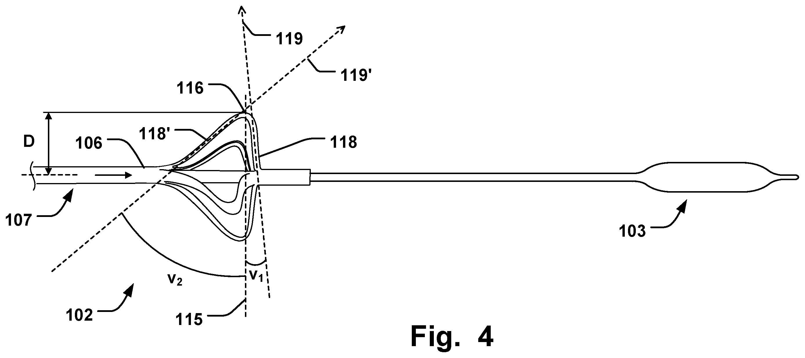 Patent US11793641 Figure 4 – Medical system for annuloplasty