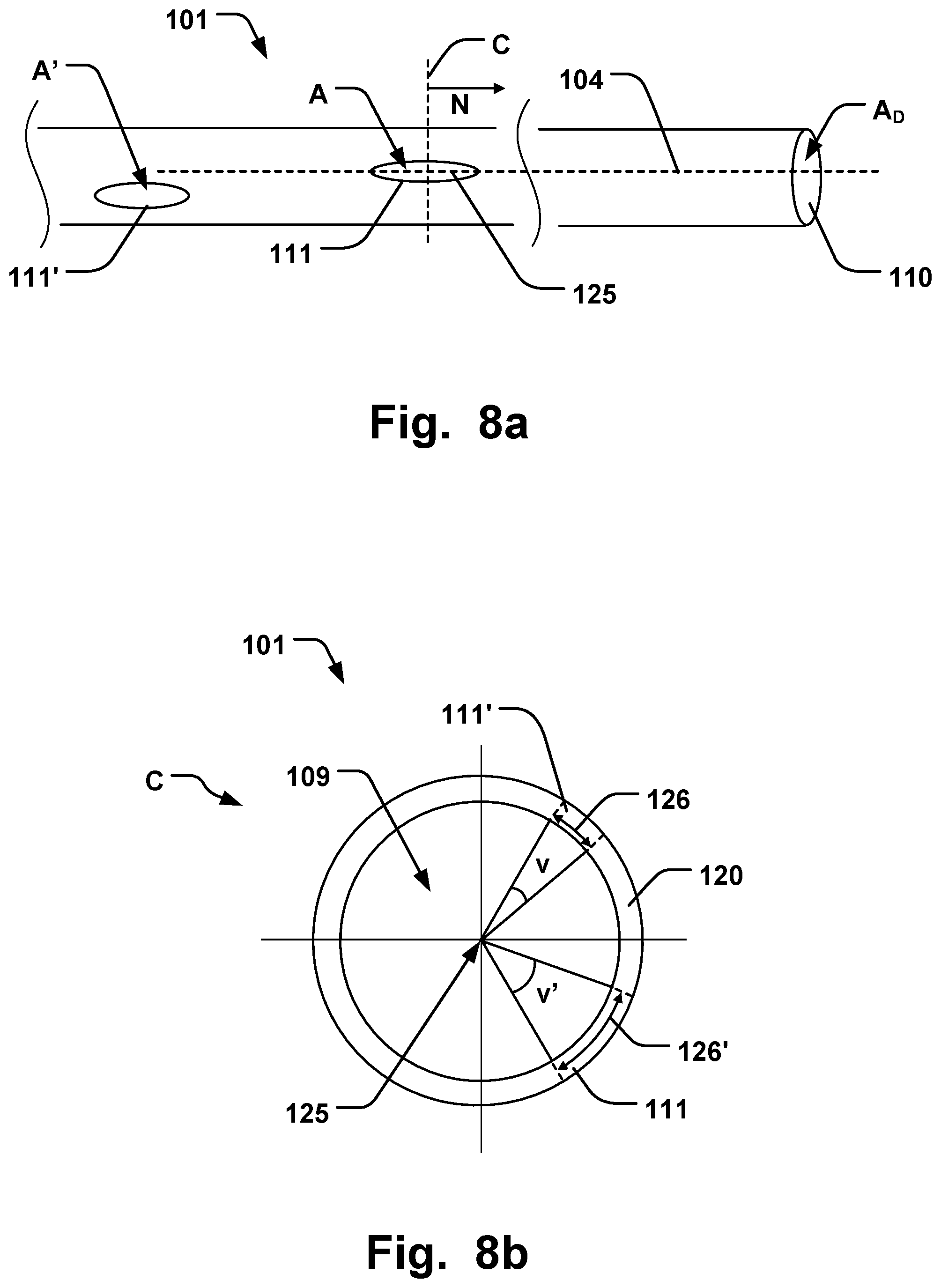 Patent US11793641 Figure 9 – Medical system for annuloplasty