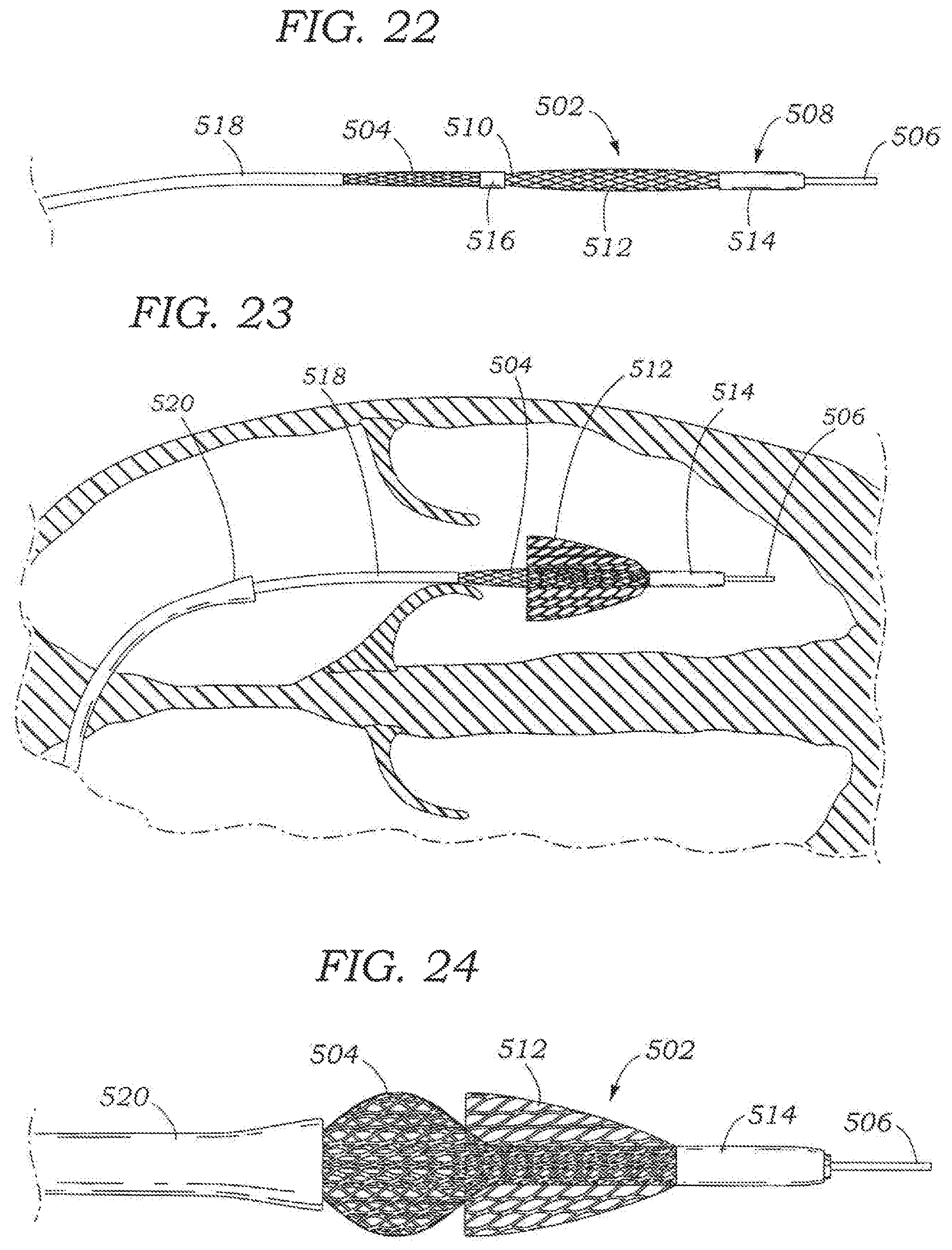Patent US11793642 Figure 10 – Heart valve sealing devices and delivery devices therefor