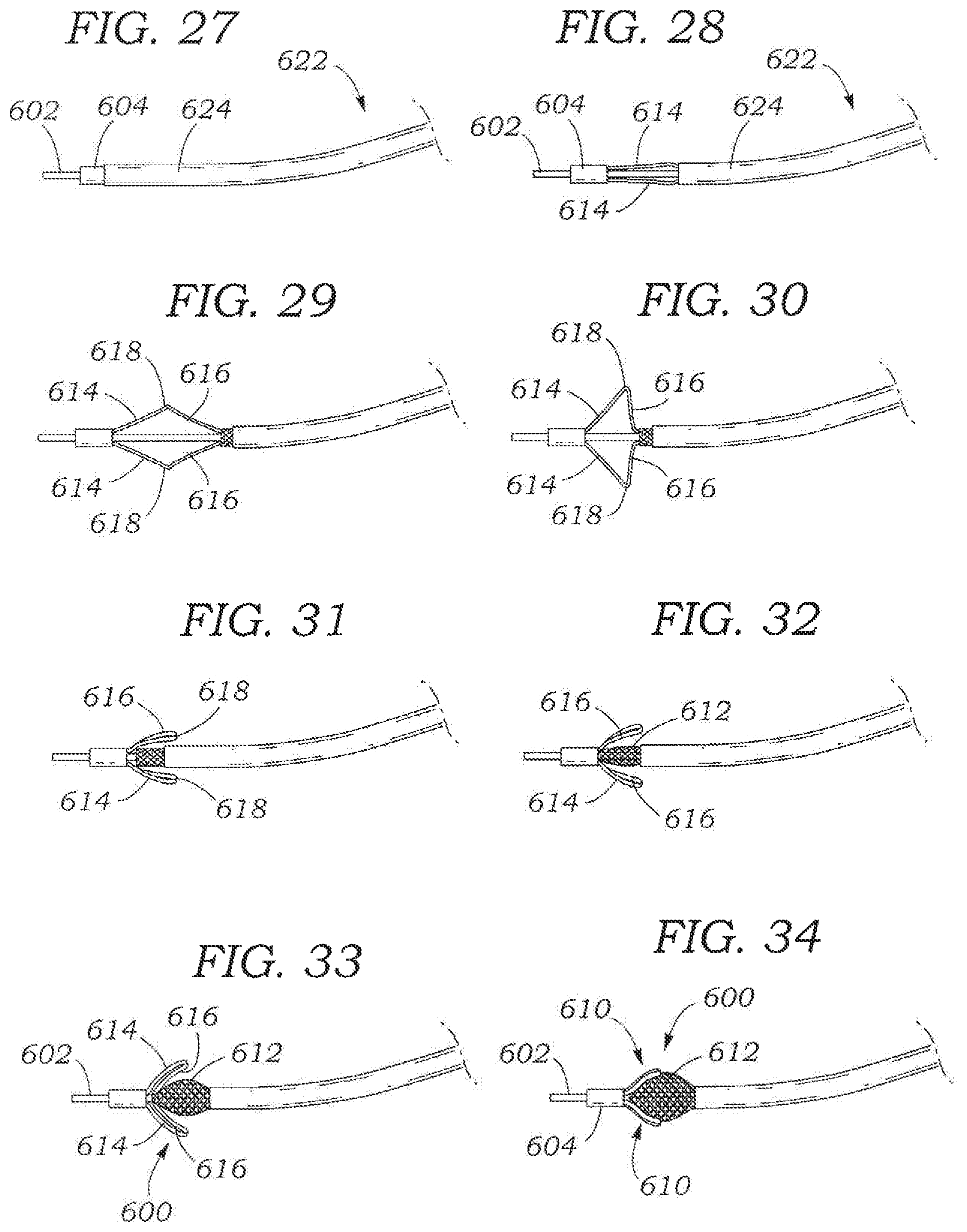Patent US11793642 Figure 12 – Heart valve sealing devices and delivery devices therefor