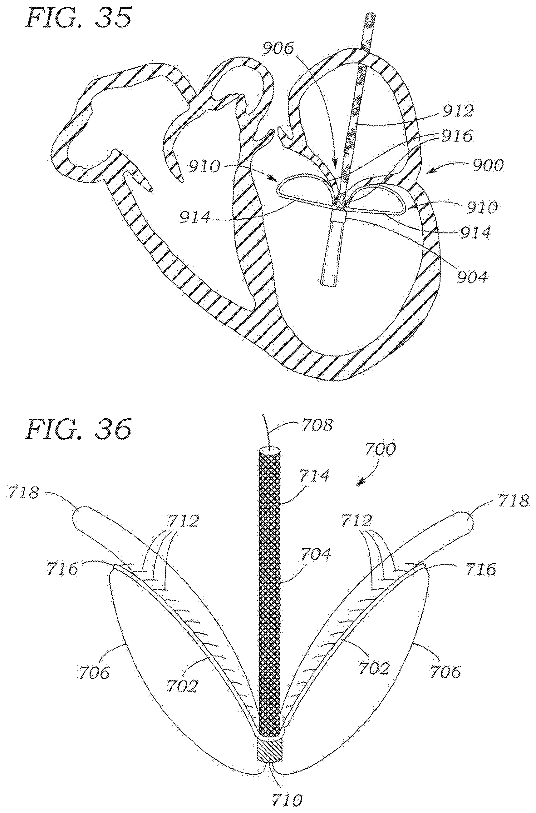 Patent US11793642 Figure 13 – Heart valve sealing devices and delivery devices therefor