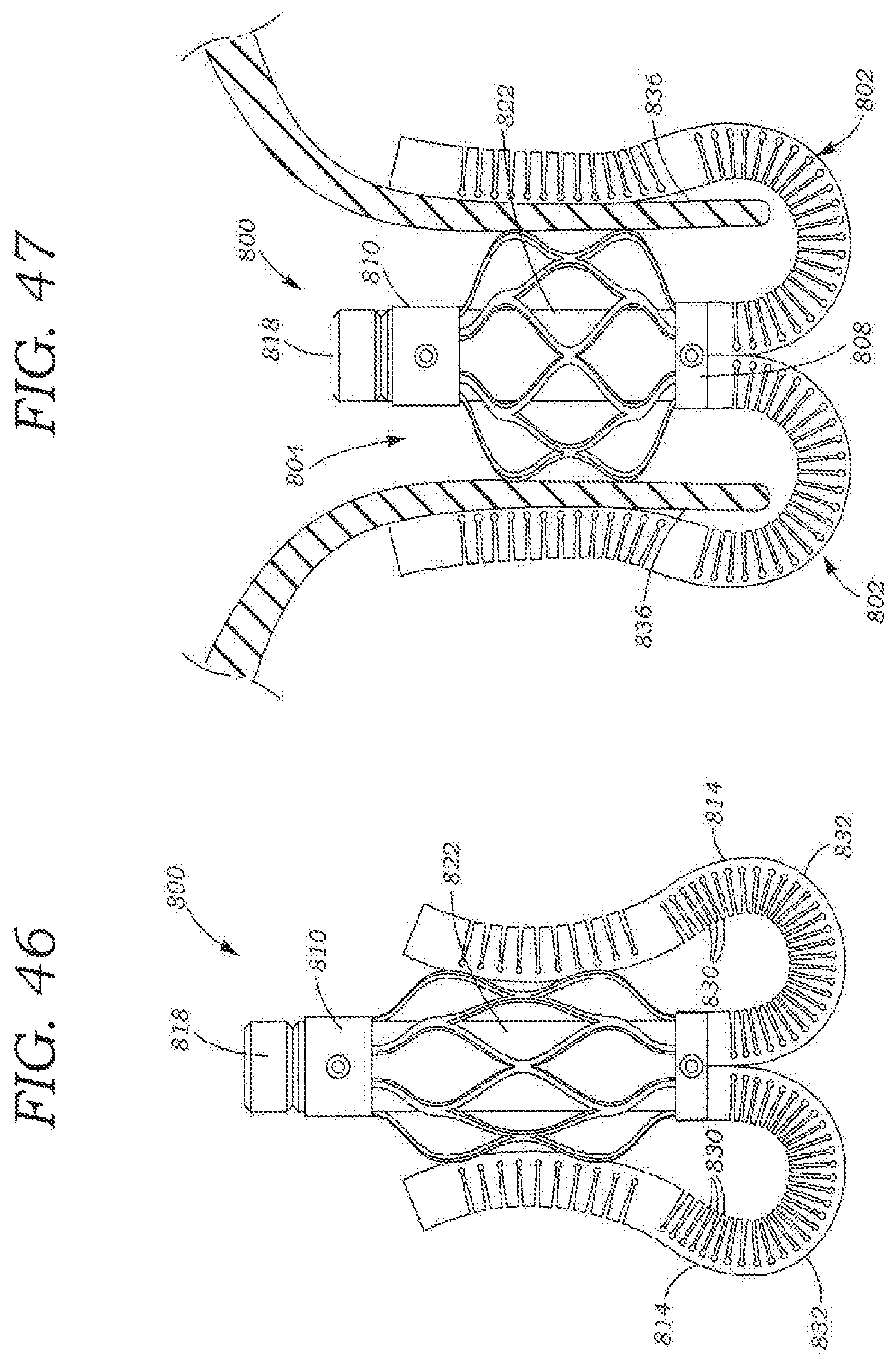 Patent US11793642 Figure 17 – Heart valve sealing devices and delivery devices therefor