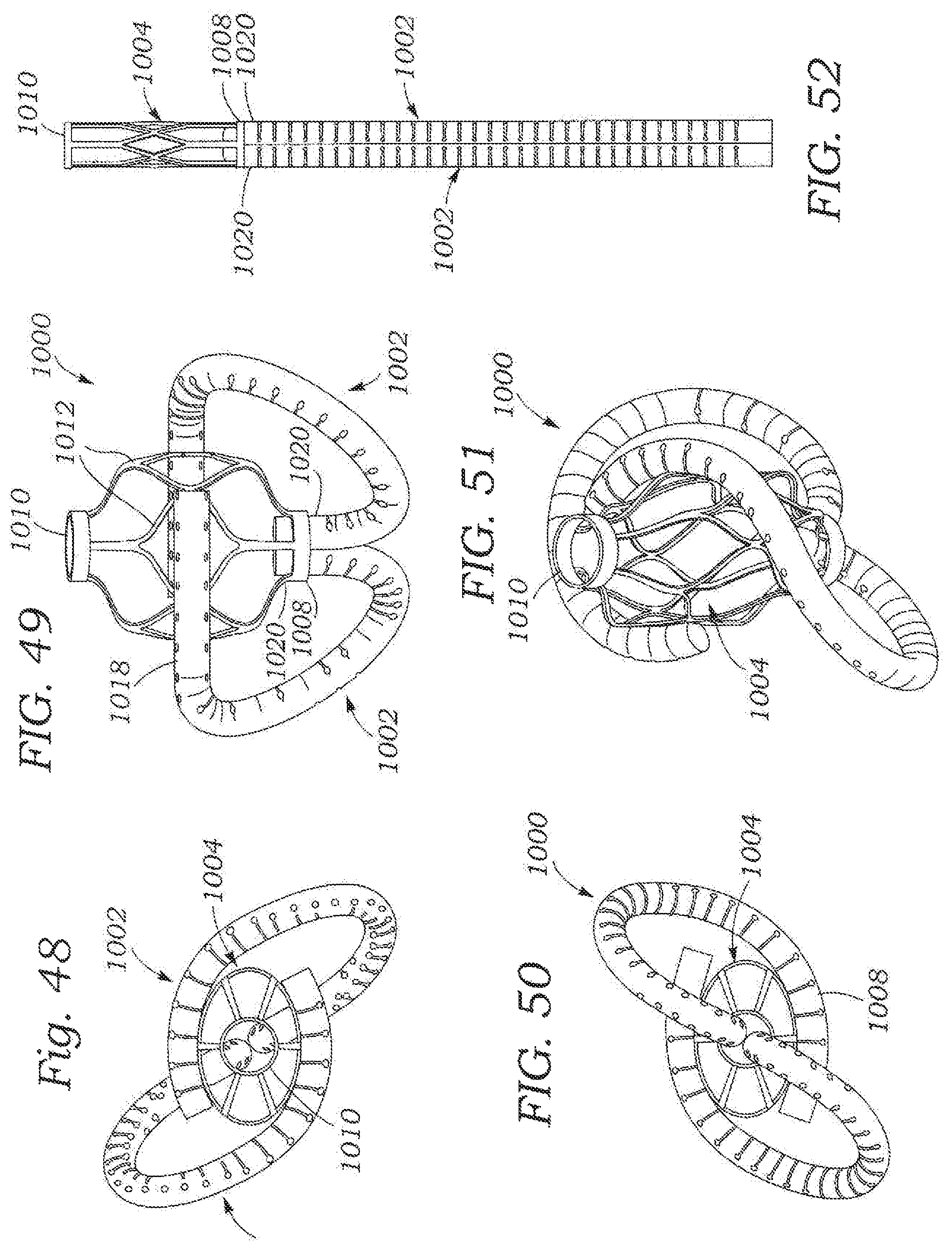 Patent US11793642 Figure 18 – Heart valve sealing devices and delivery devices therefor