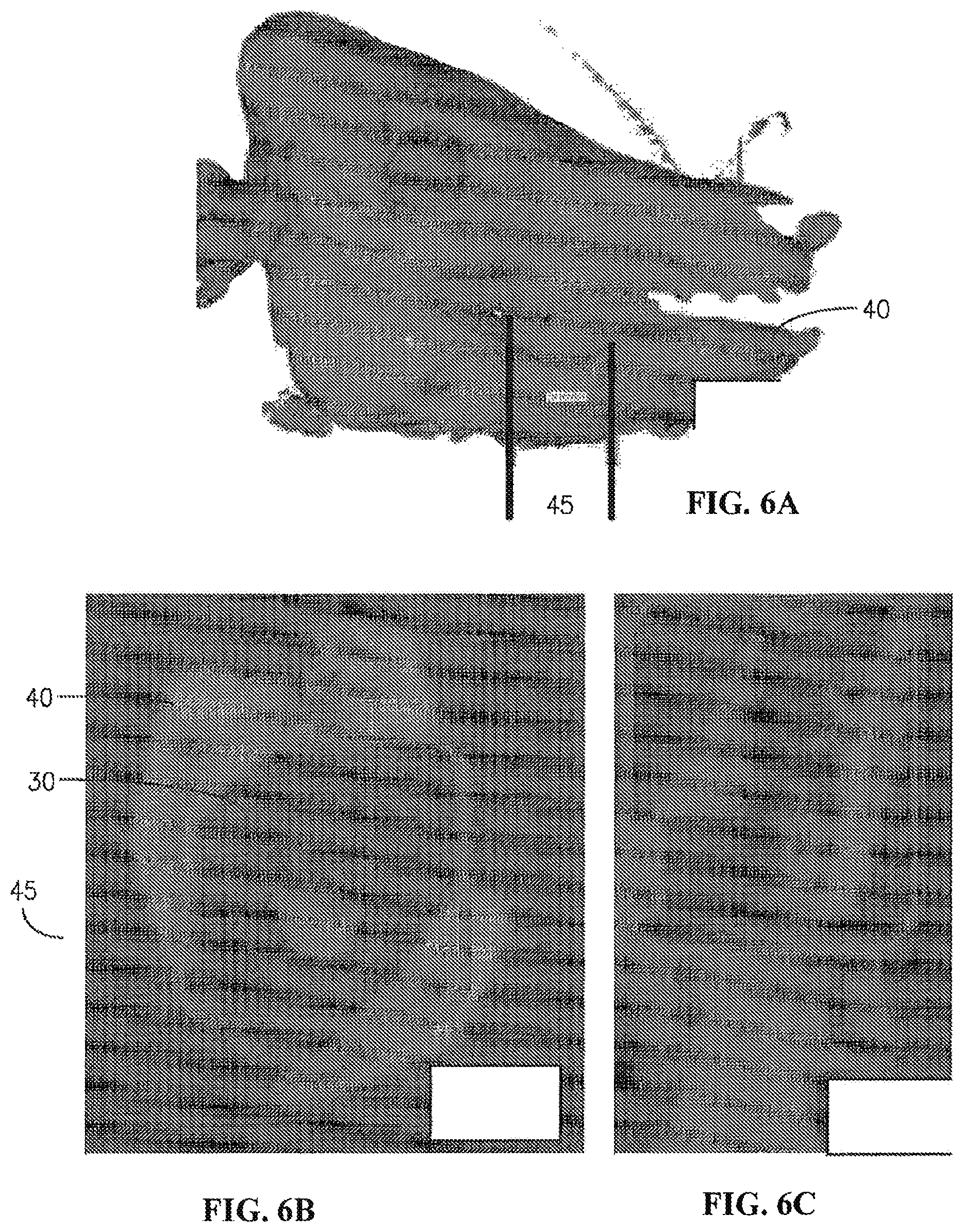 Patent US11793644 Figure 6 – Modular tissue scaffolds