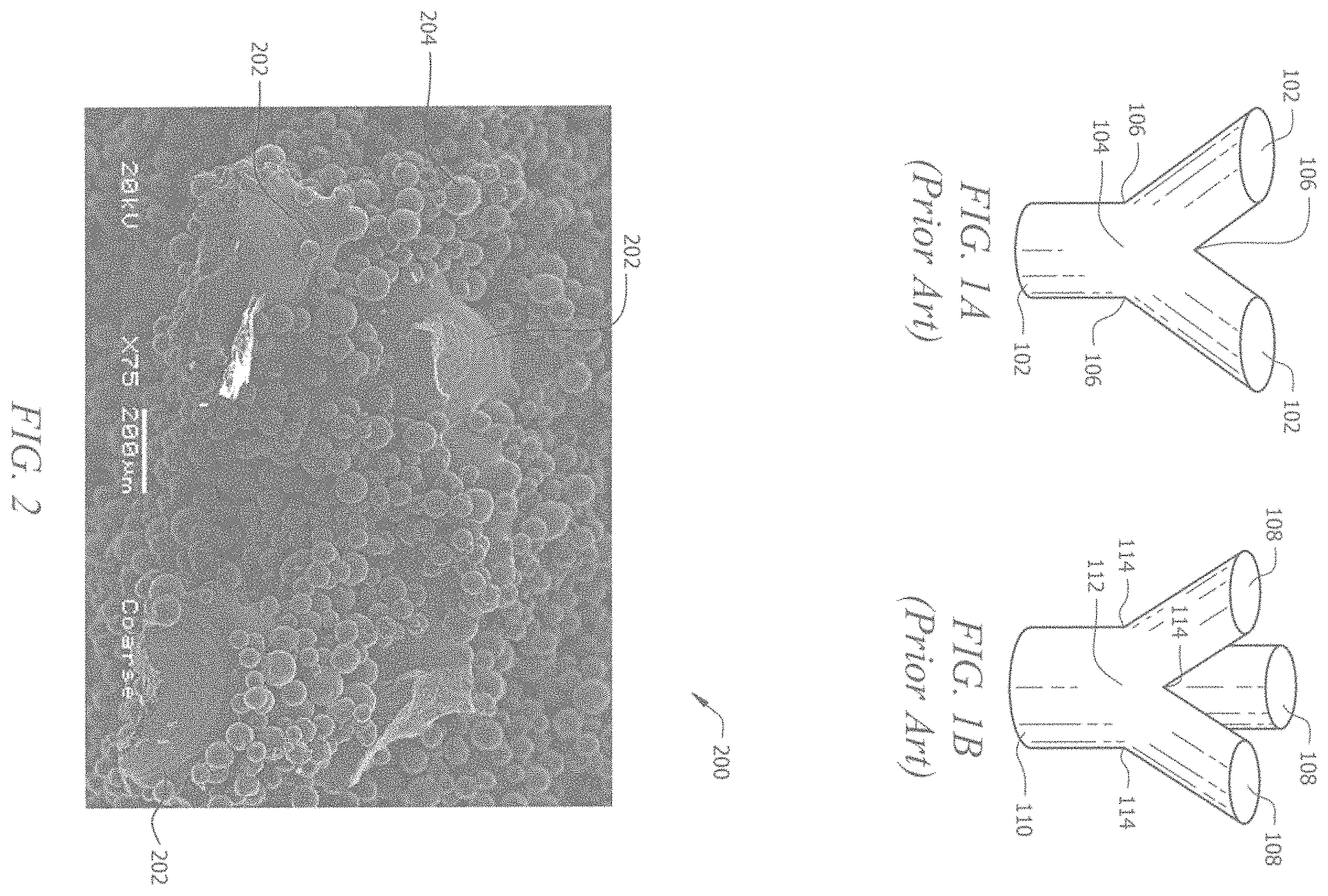 Patent US11793645 Figure 1 – Porous implant structures