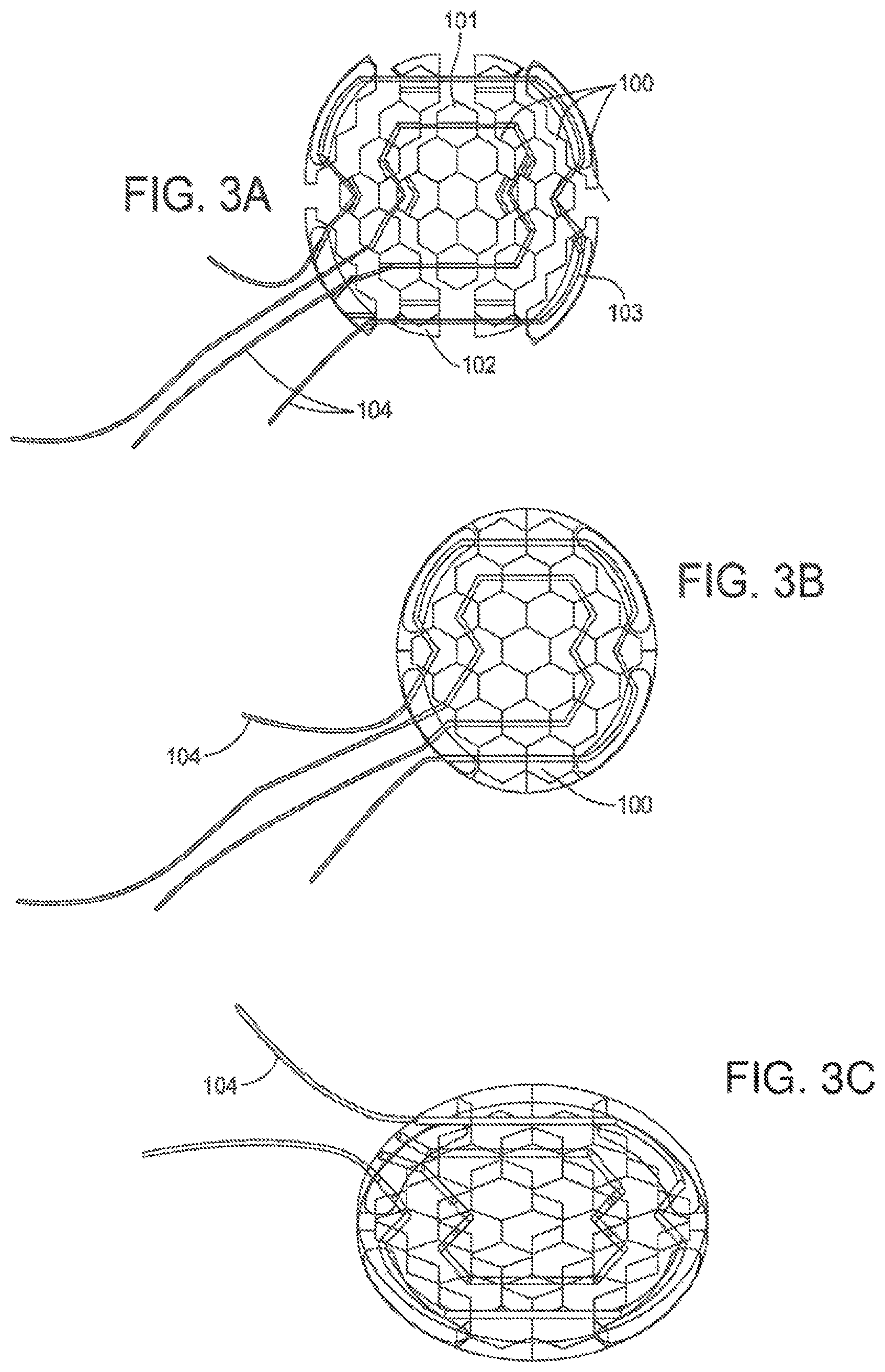 Patent US11793646 Figure 2 – Rigid segmented flexible anchors