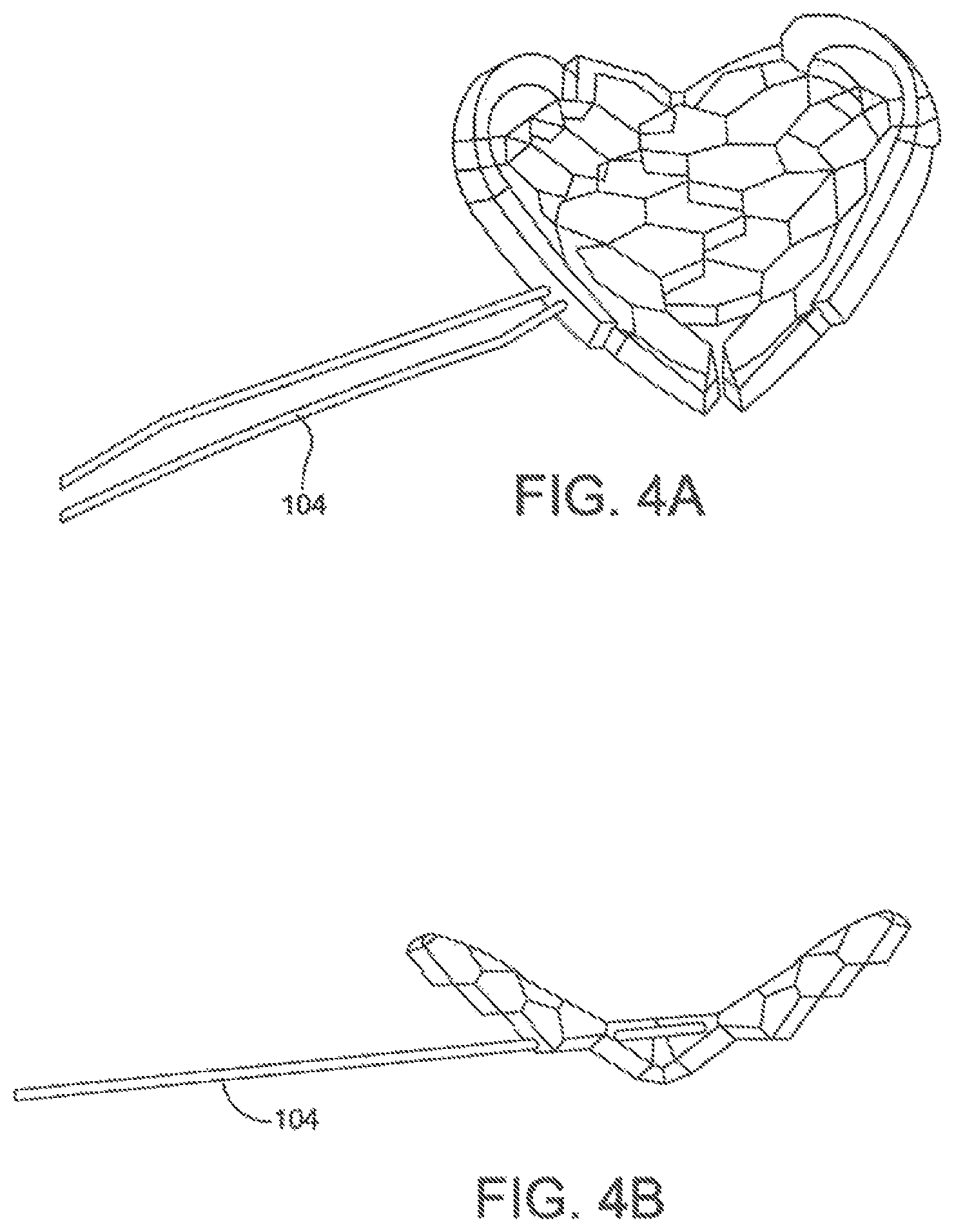 Patent US11793646 Figure 3 – Rigid segmented flexible anchors