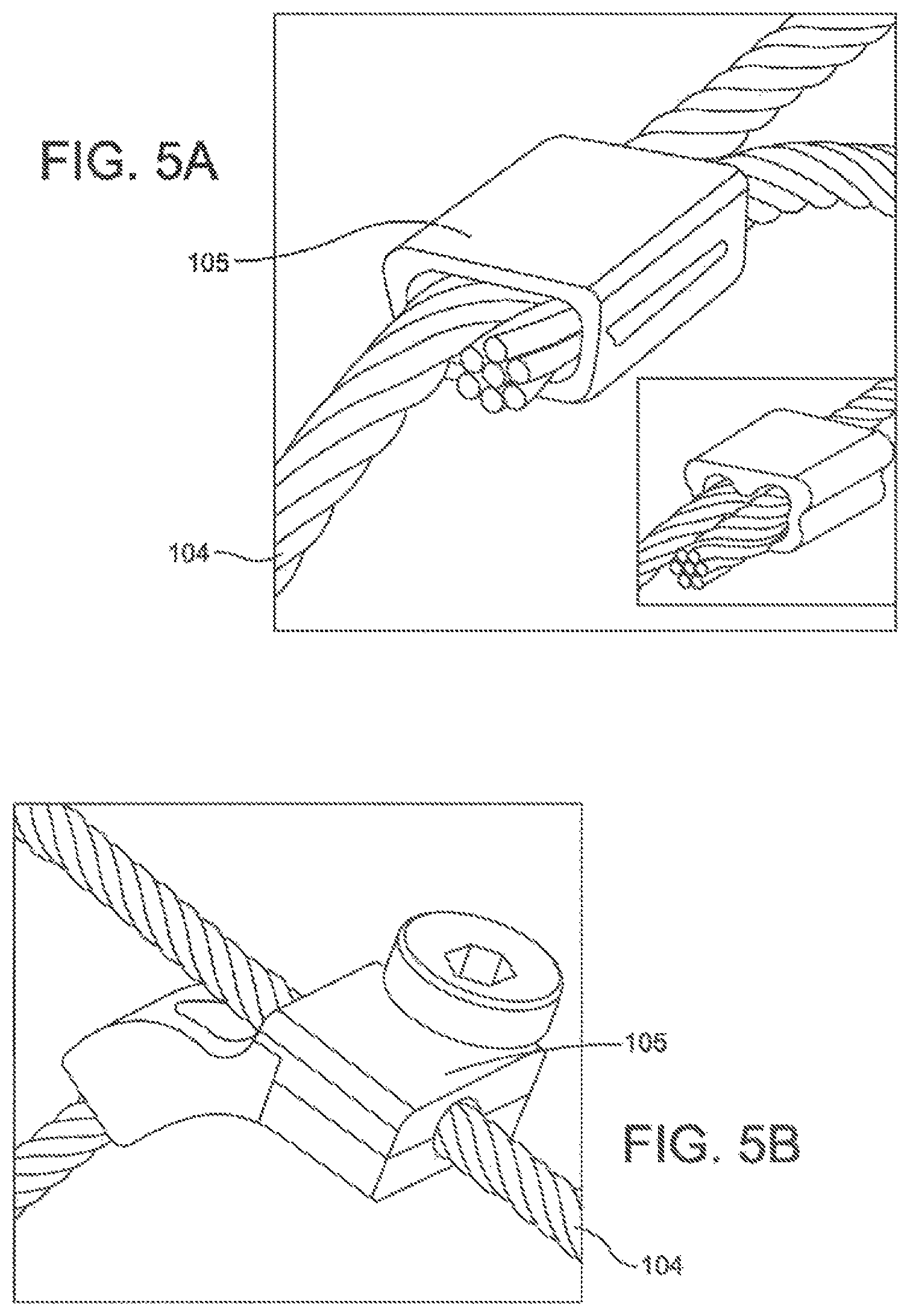 Patent US11793646 Figure 4 – Rigid segmented flexible anchors