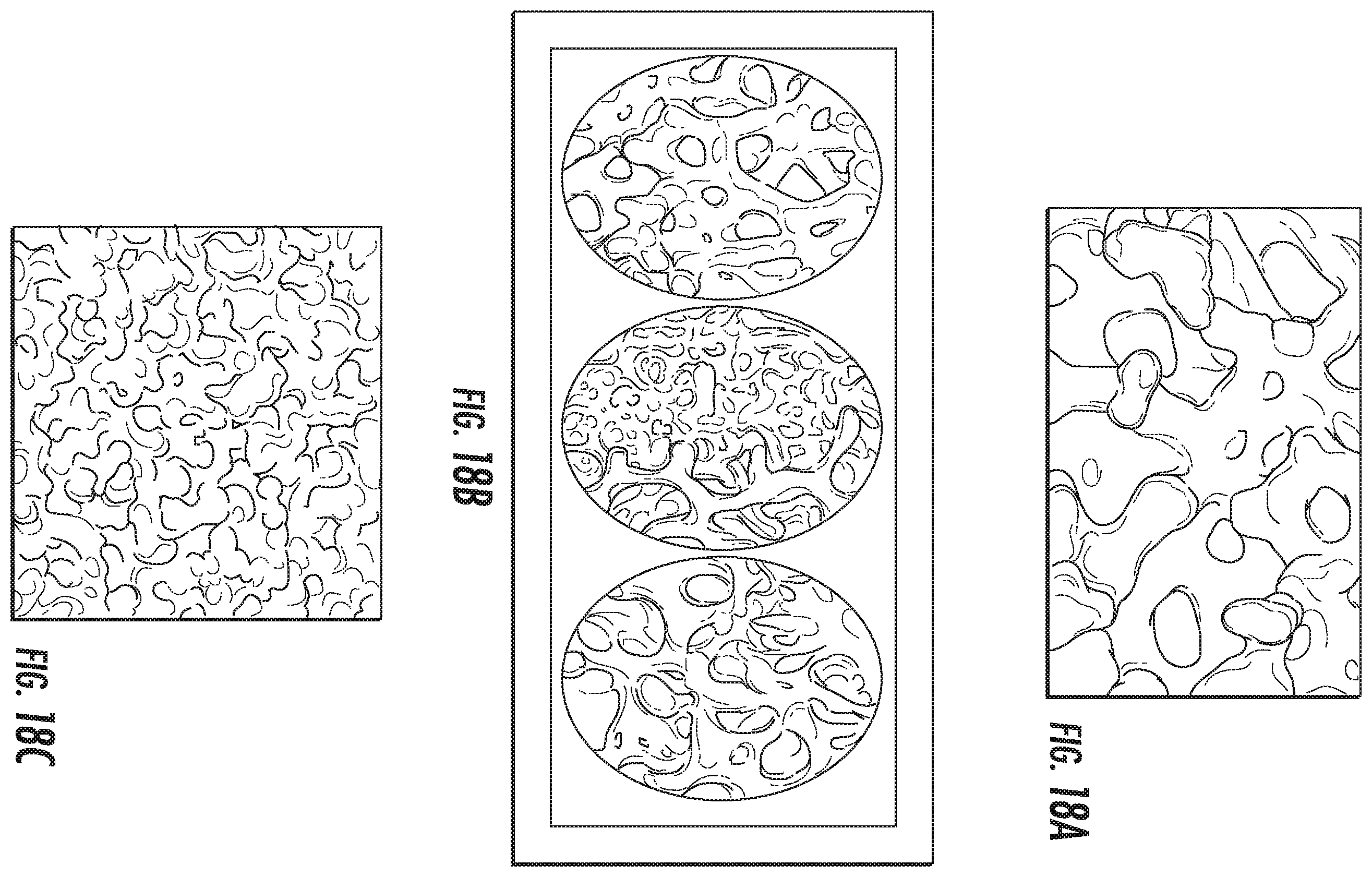 Patent US11793646 Figure 11 – Rigid segmented flexible anchors