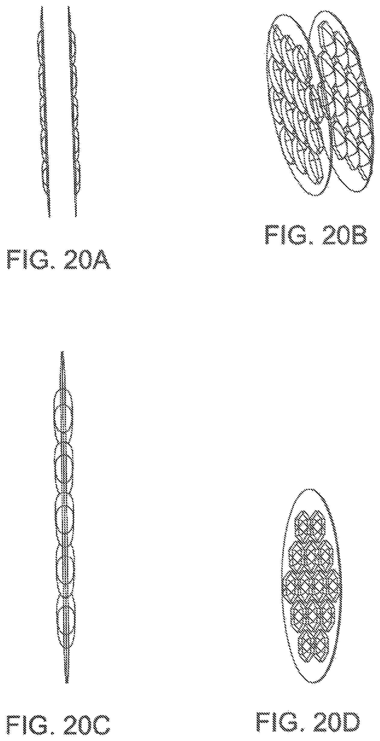 Patent US11793646 Figure 13 – Rigid segmented flexible anchors