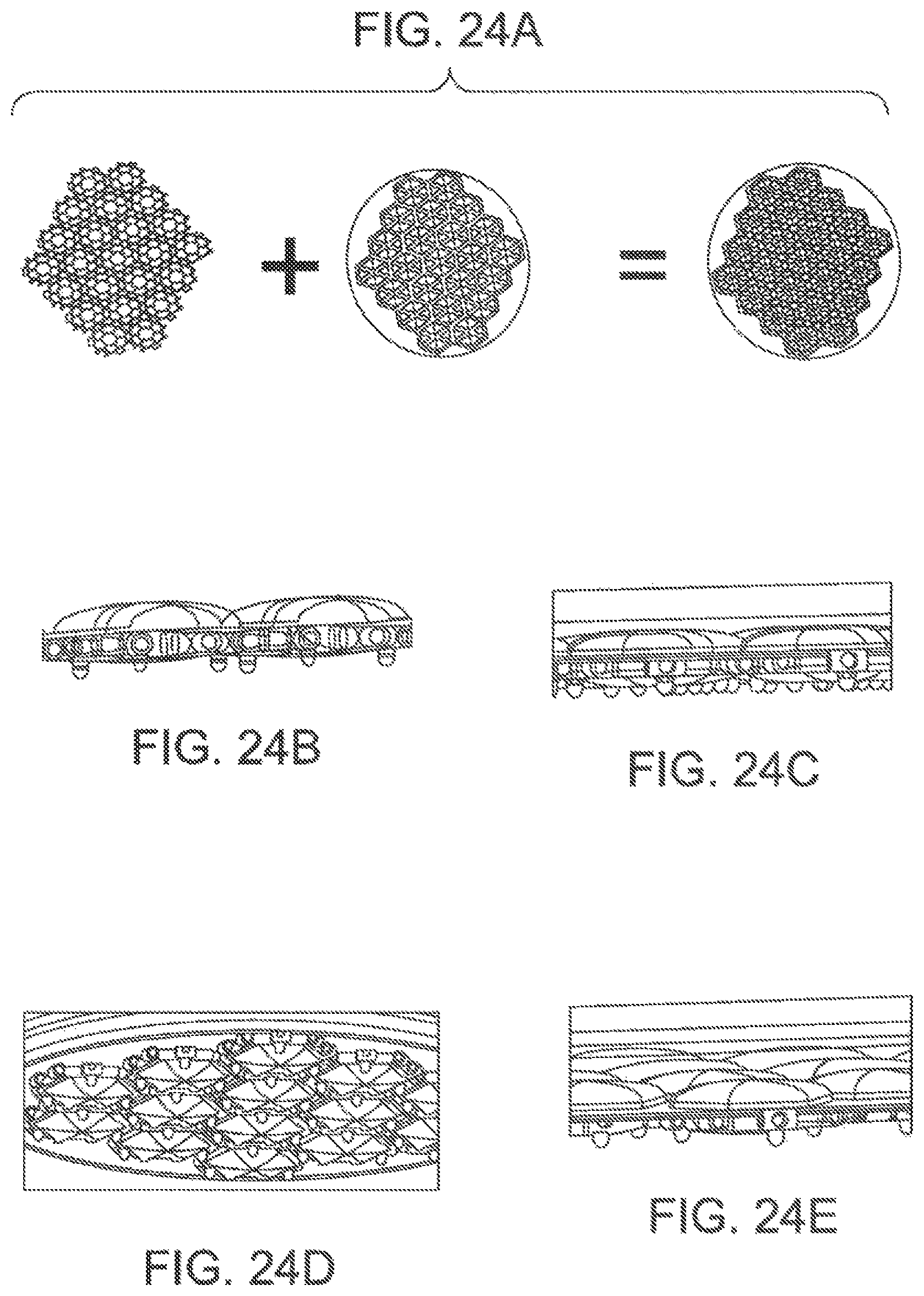 Patent US11793646 Figure 17 – Rigid segmented flexible anchors