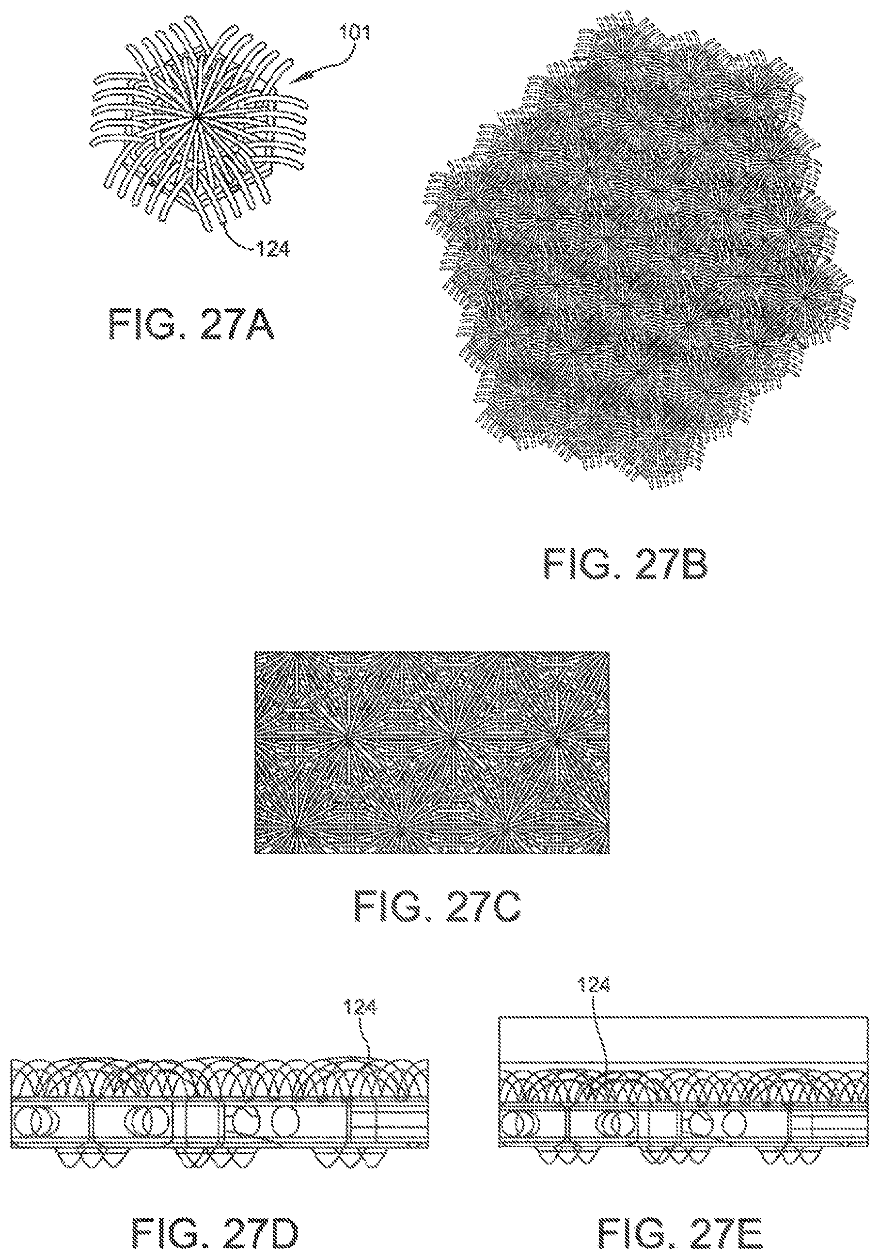 Patent US11793646 Figure 20 – Rigid segmented flexible anchors