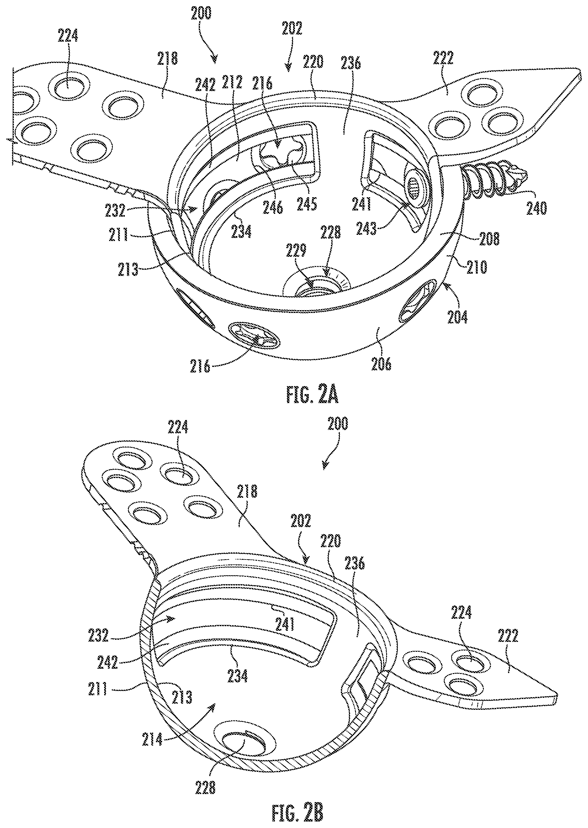 Patent US11793647 Figure 3 – Acetabular apparatuses for hip revision surgery