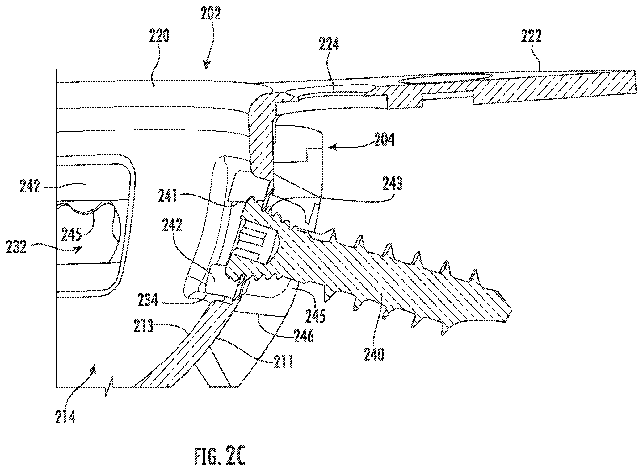 Patent US11793647 Figure 4 – Acetabular apparatuses for hip revision surgery