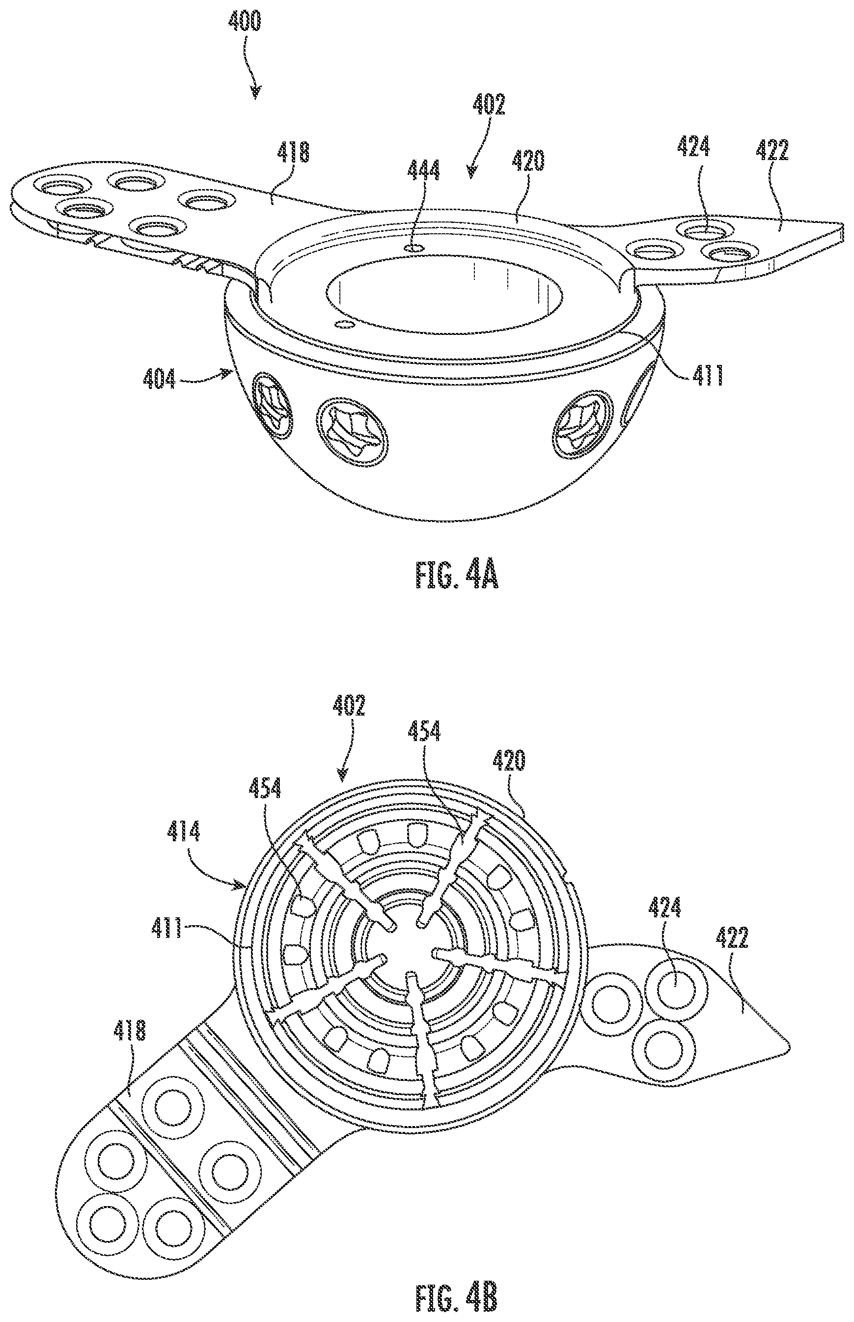 Patent US11793647 Figure 6 – Acetabular apparatuses for hip revision surgery