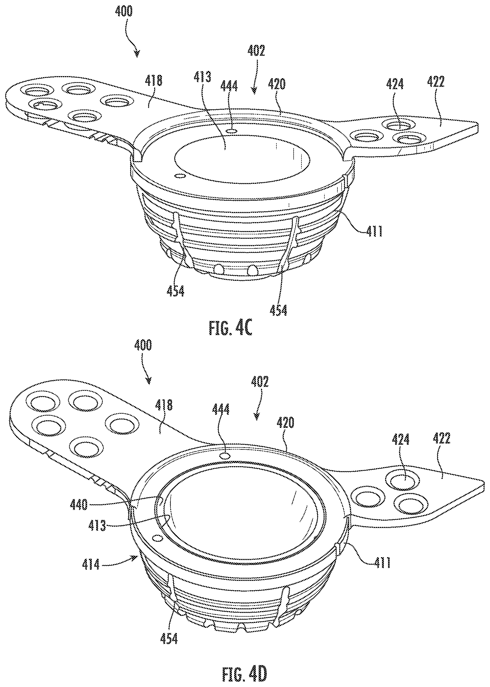Patent US11793647 Figure 7 – Acetabular apparatuses for hip revision surgery
