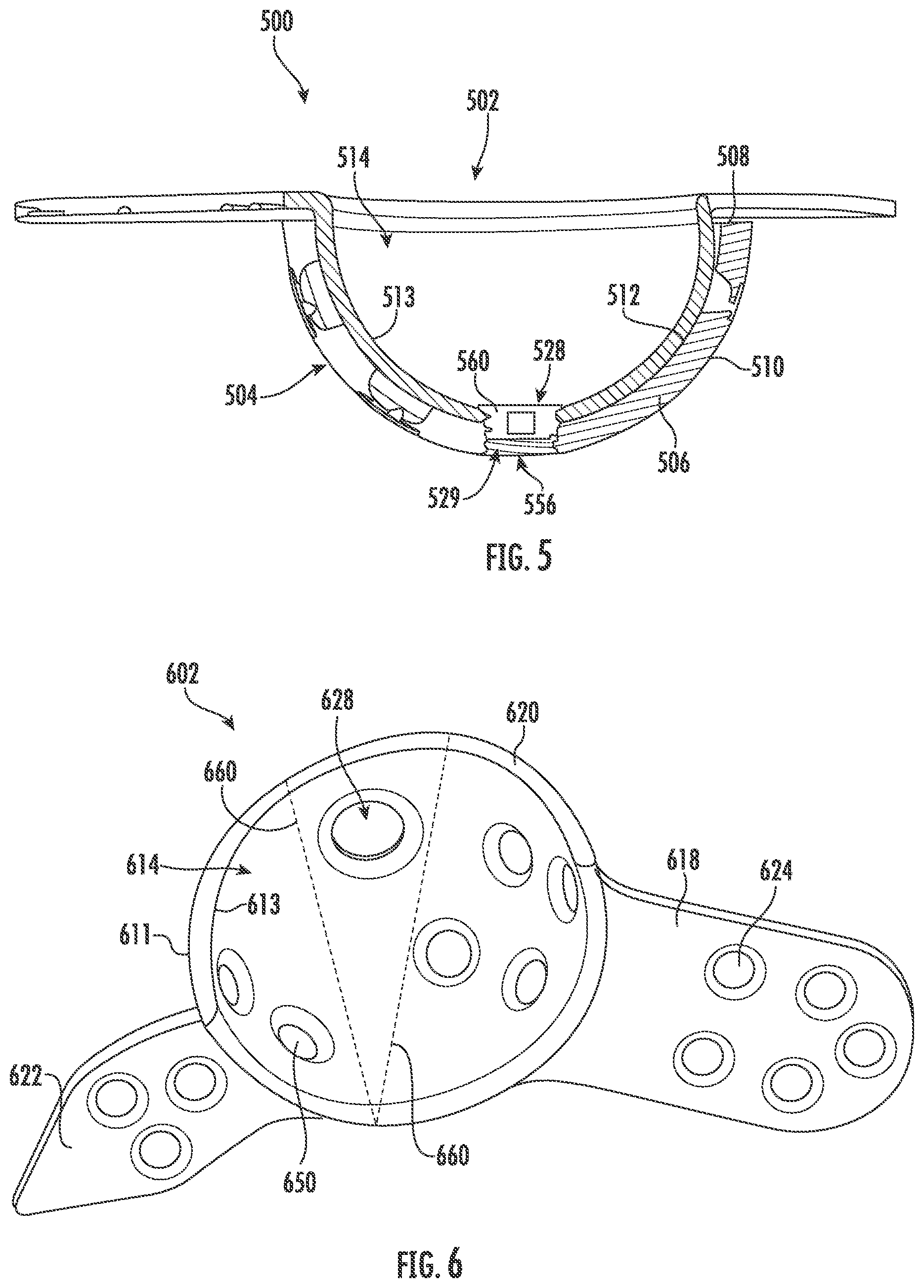 Patent US11793647 Figure 8 – Acetabular apparatuses for hip revision surgery
