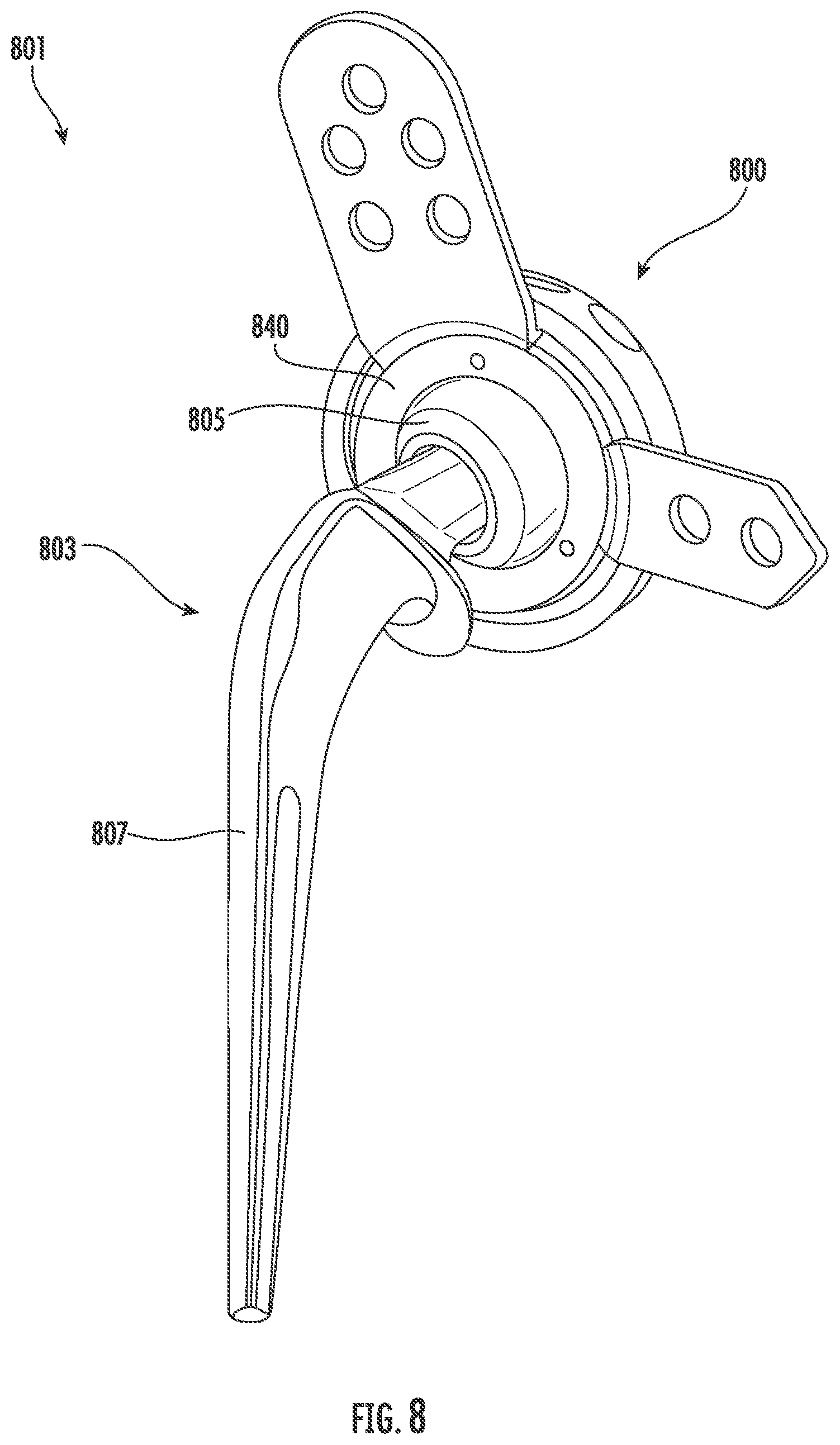 Patent US11793647 Figure 10 – Acetabular apparatuses for hip revision surgery