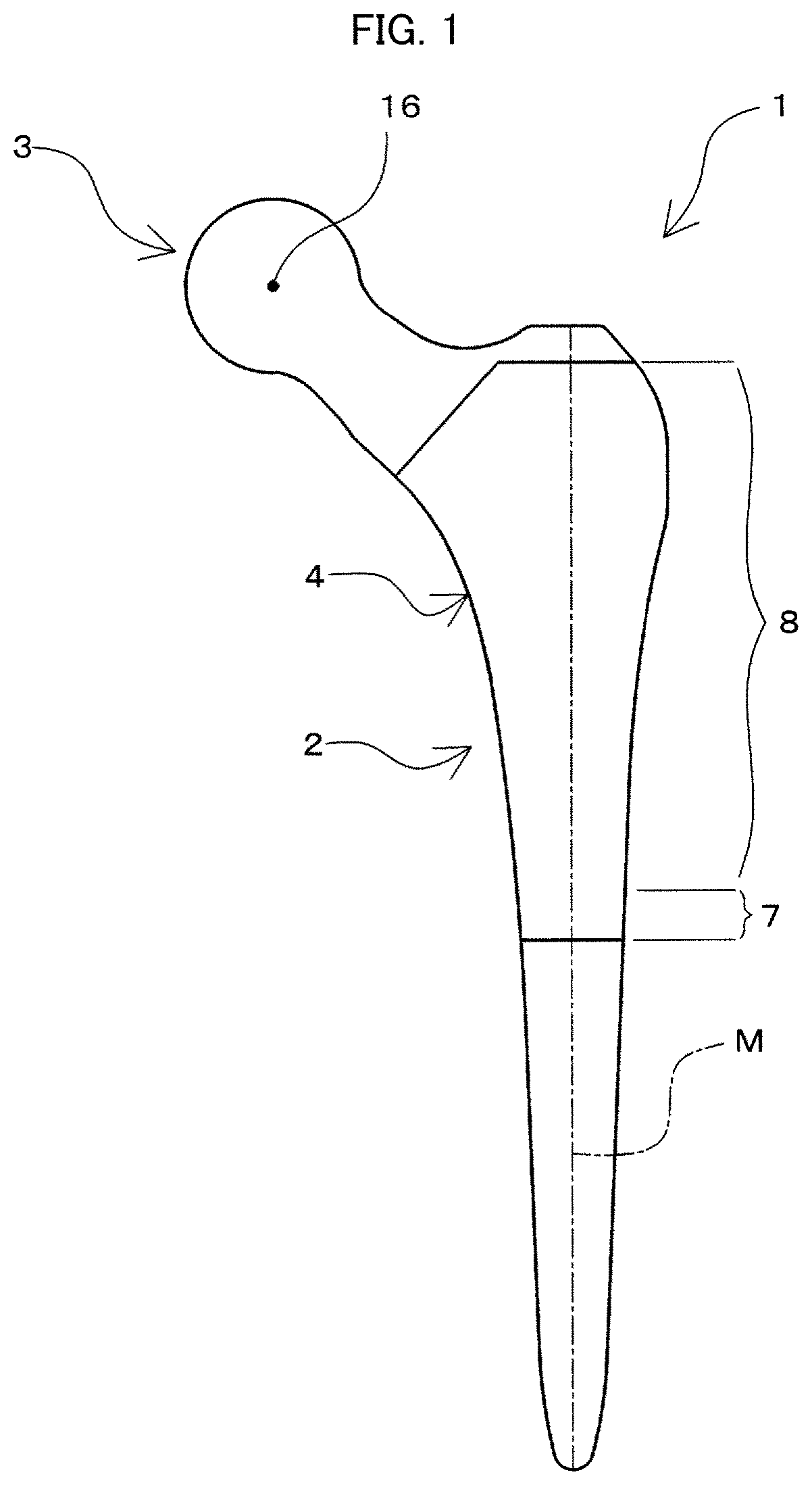 Patent US11793648 Figure 1 – Prosthetic joint and manufacturing method for same