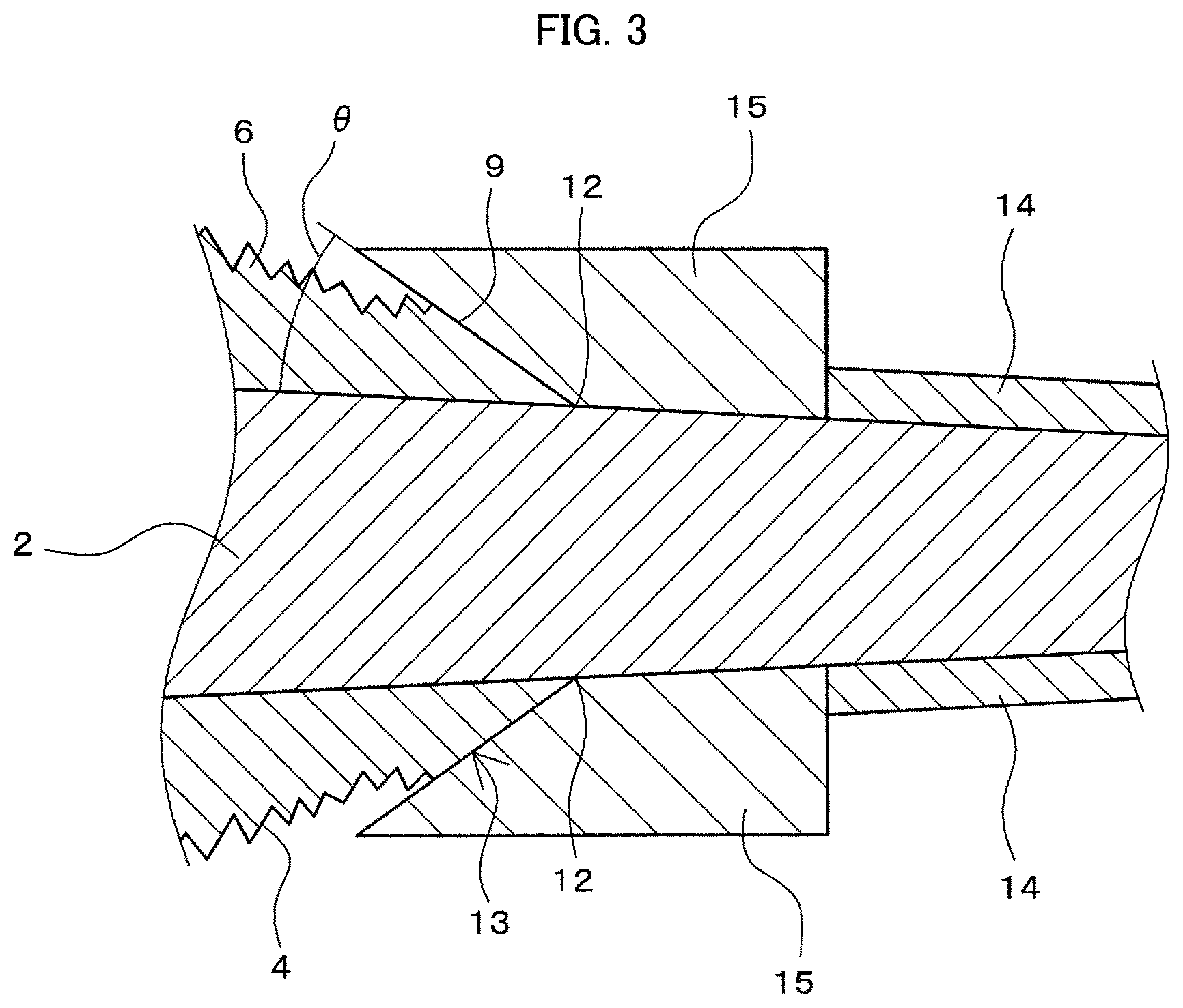 Patent US11793648 Figure 3 – Prosthetic joint and manufacturing method for same