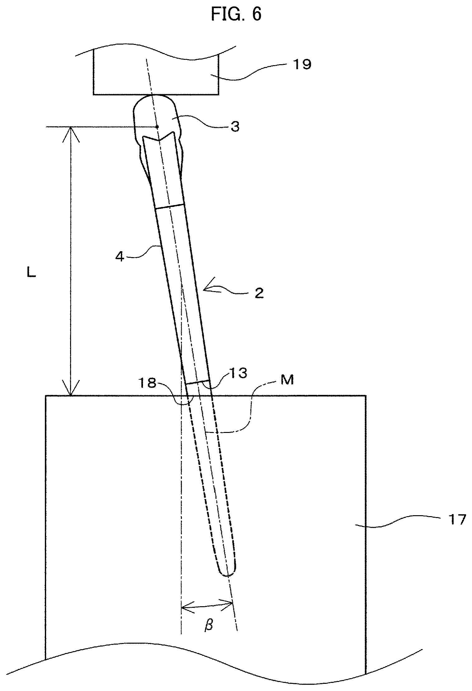 Patent US11793648 Figure 6 – Prosthetic joint and manufacturing method for same