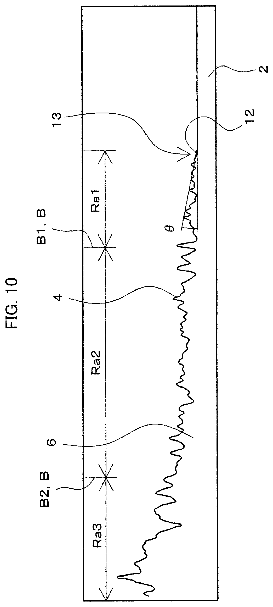 Patent US11793648 Figure 10 – Prosthetic joint and manufacturing method for same