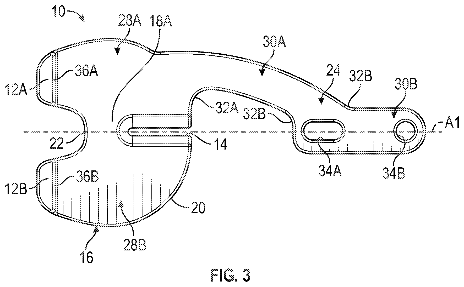 Patent US11793650 Figure 2 – Prosthetic knee implant systems and methods with linked tibial rotation