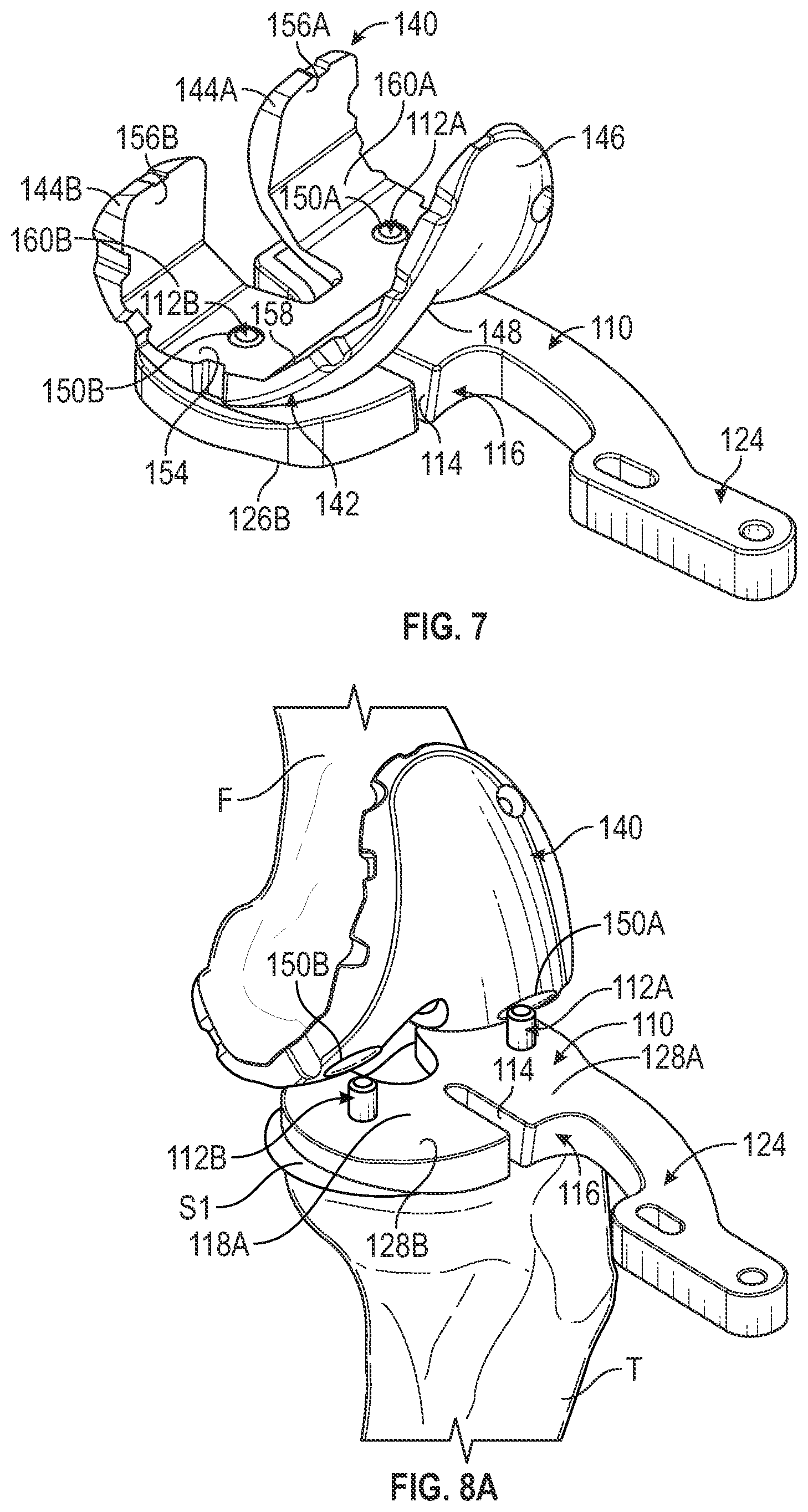 Patent US11793650 Figure 7 – Prosthetic knee implant systems and methods with linked tibial rotation