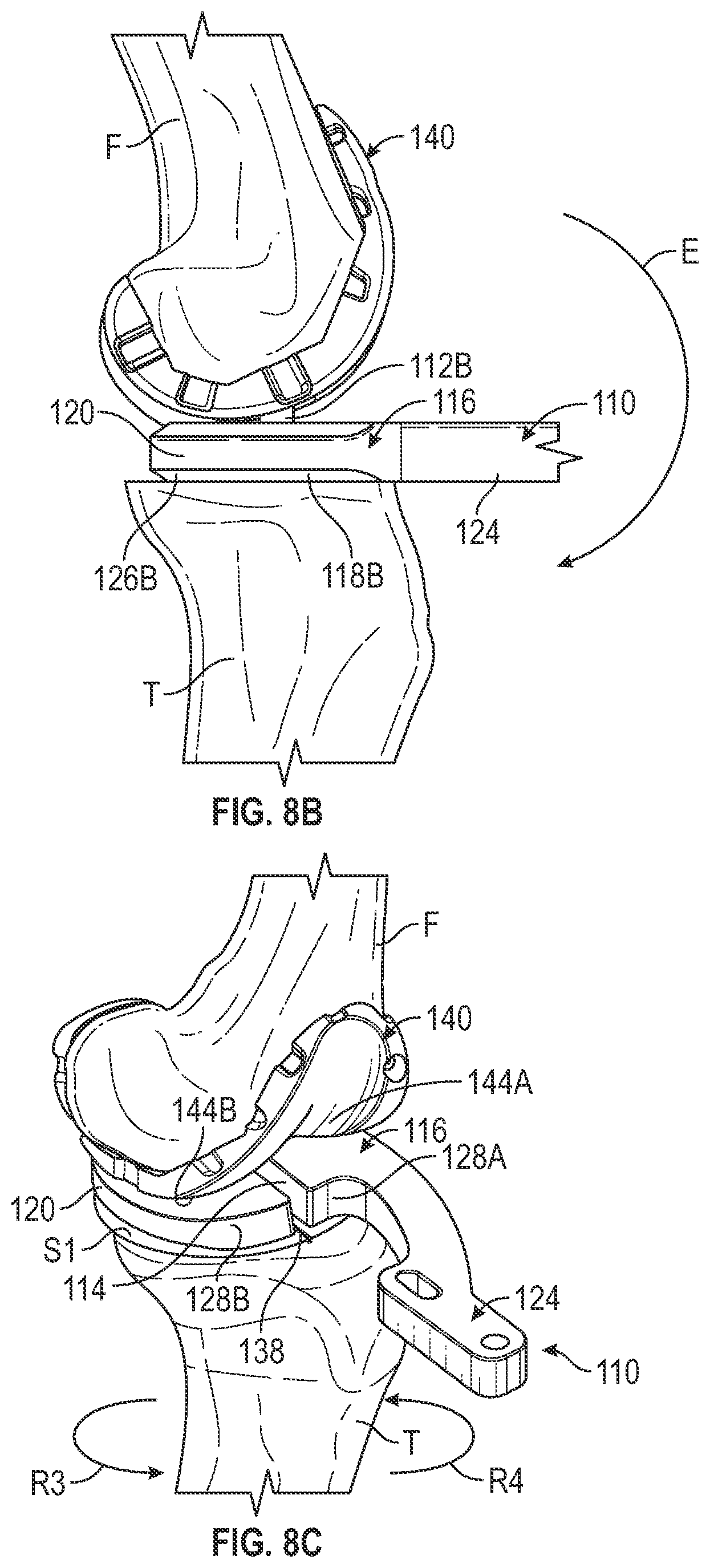 Patent US11793650 Figure 8 – Prosthetic knee implant systems and methods with linked tibial rotation