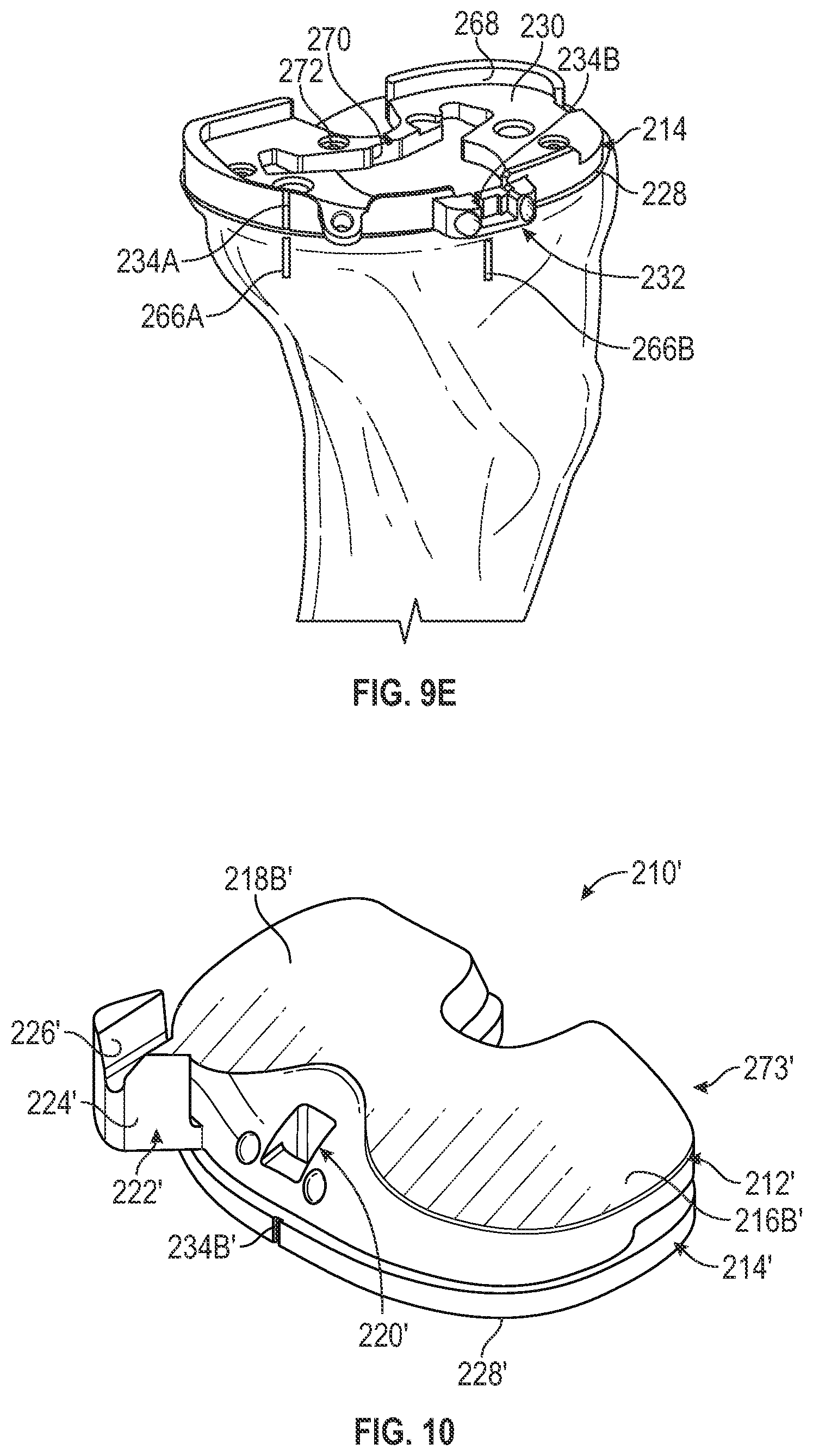 Patent US11793650 Figure 11 – Prosthetic knee implant systems and methods with linked tibial rotation