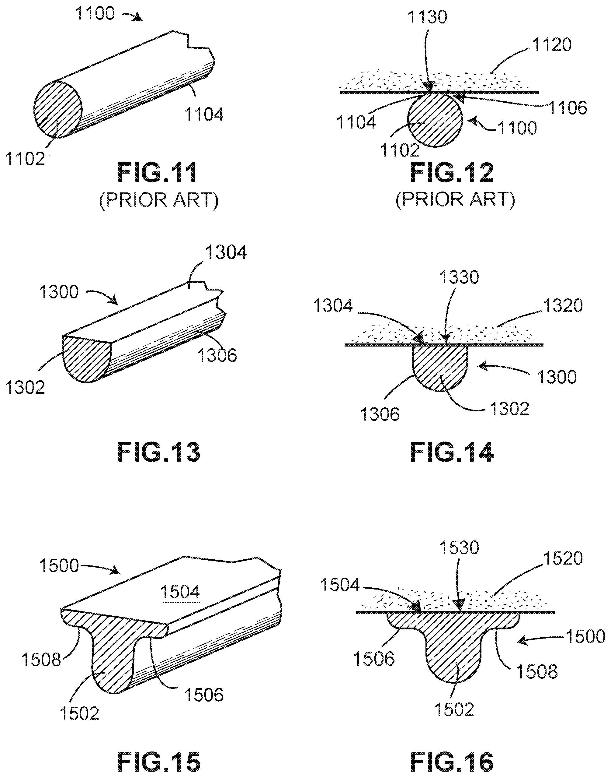 Patent US11793652 Figure 9 – Implant with improved bone contact