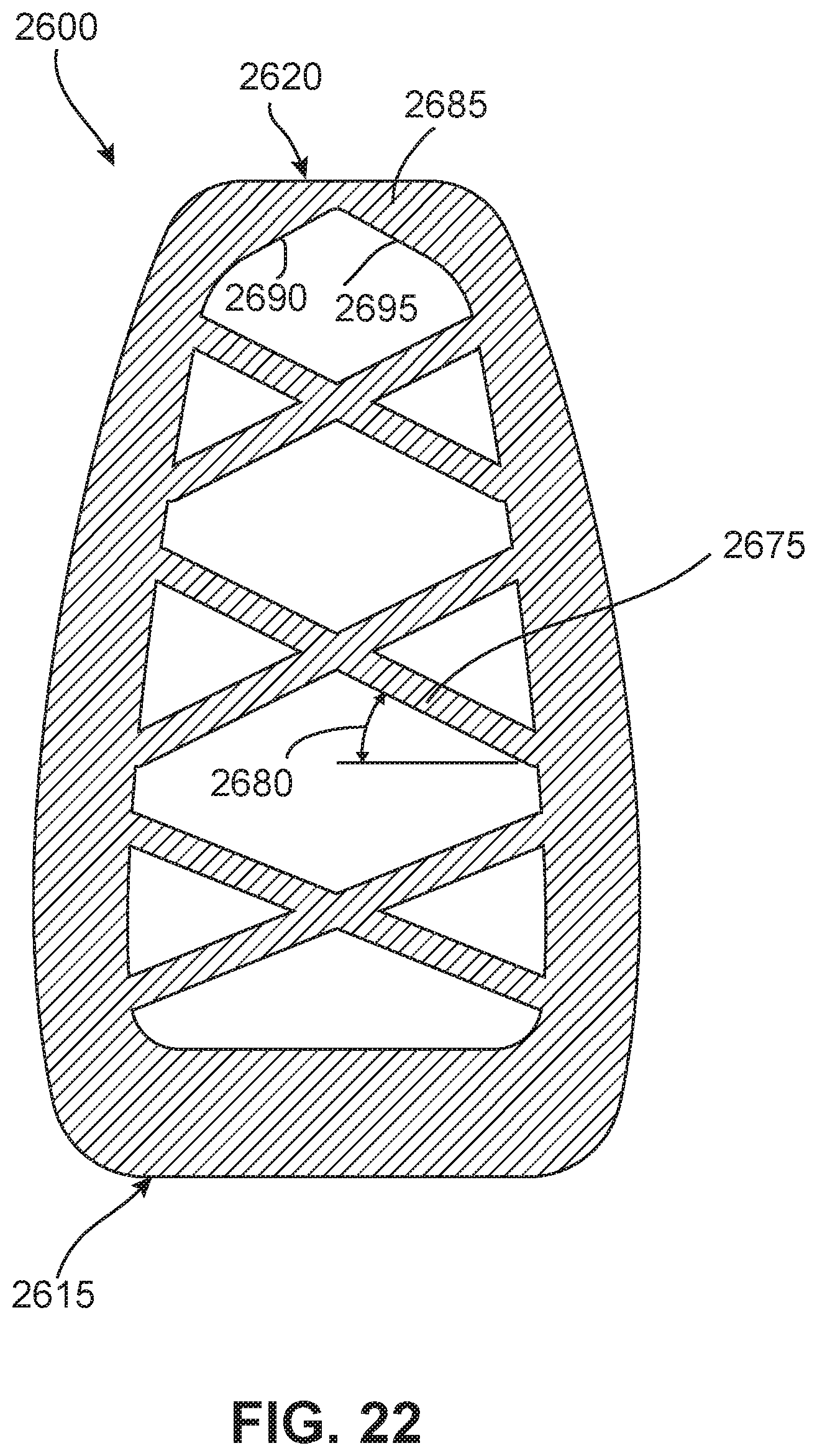 Patent US11793652 Figure 12 – Implant with improved bone contact