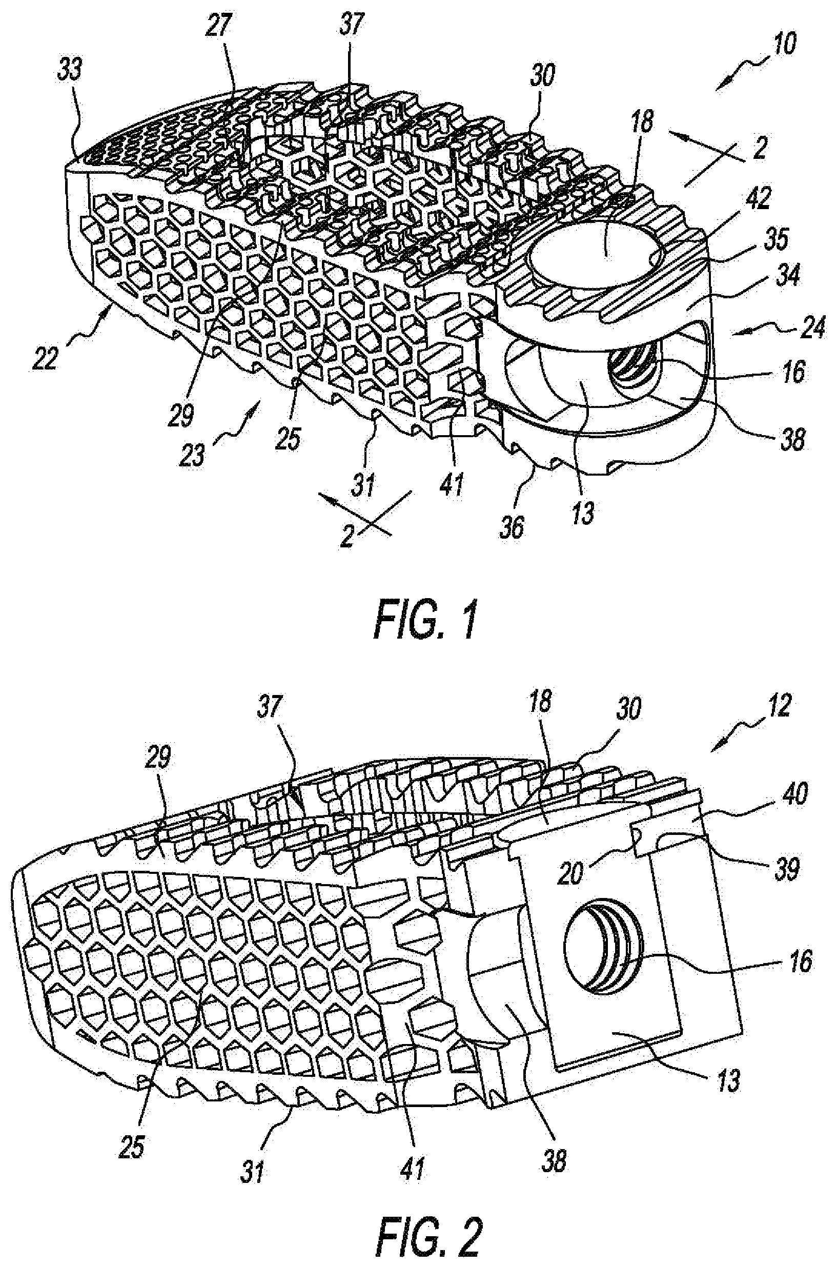 Patent US11793655 Figure 1 – Steerable spine implants