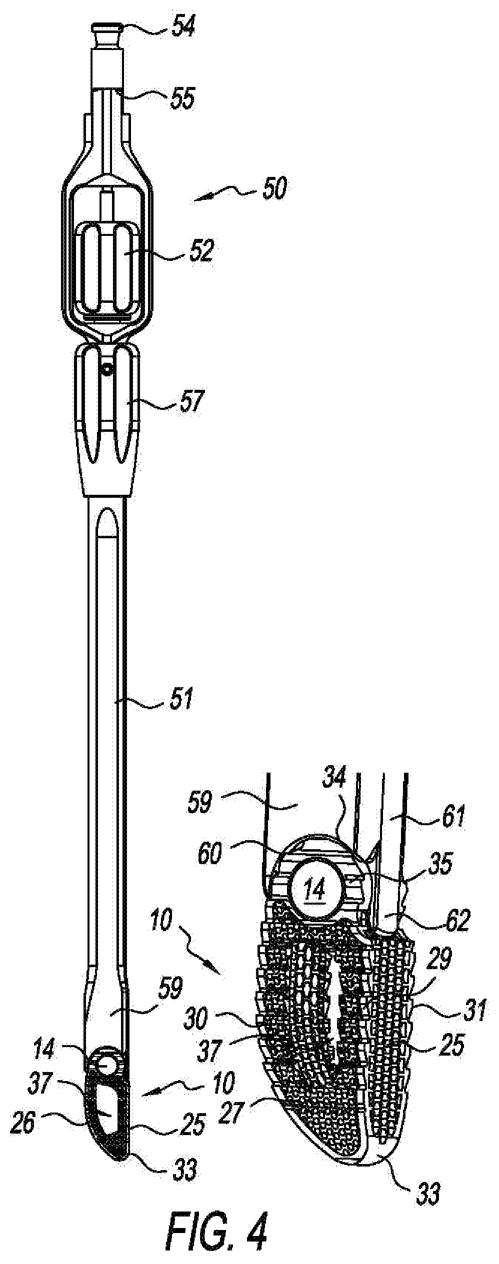 Patent US11793655 Figure 3 – Steerable spine implants